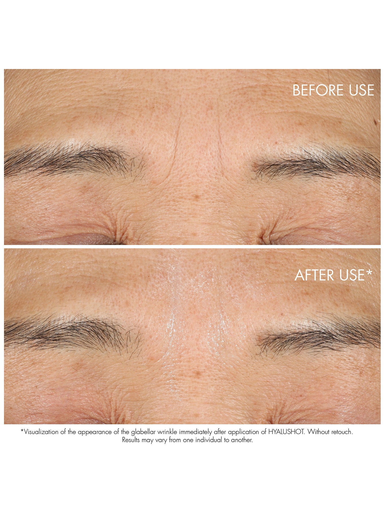 Capture Totale Hyalushot Concentre 15ml