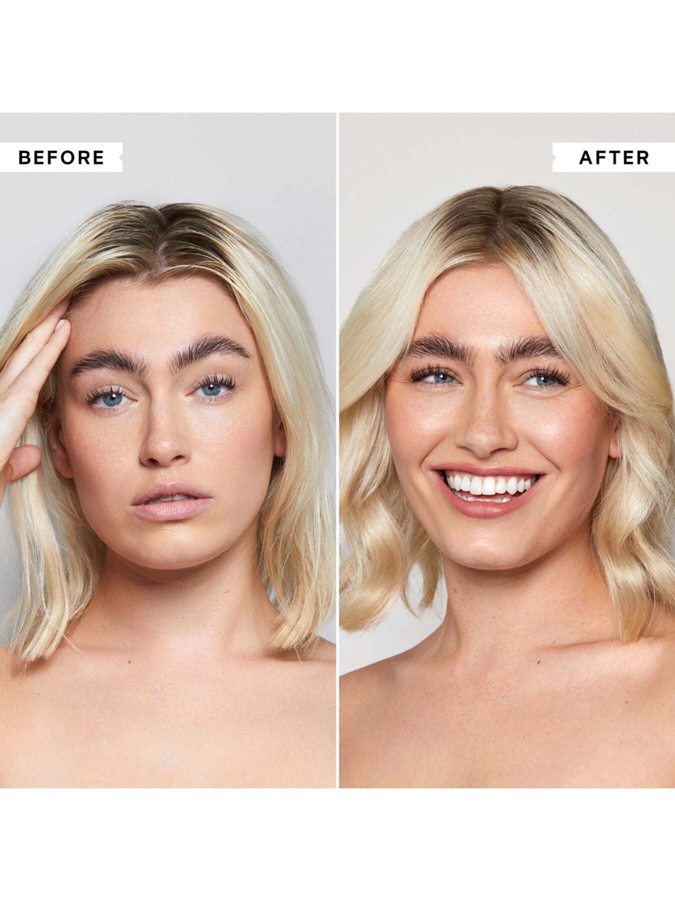 FlakyItchy Scalp Anti-Dandruff Shampoo 250 ml