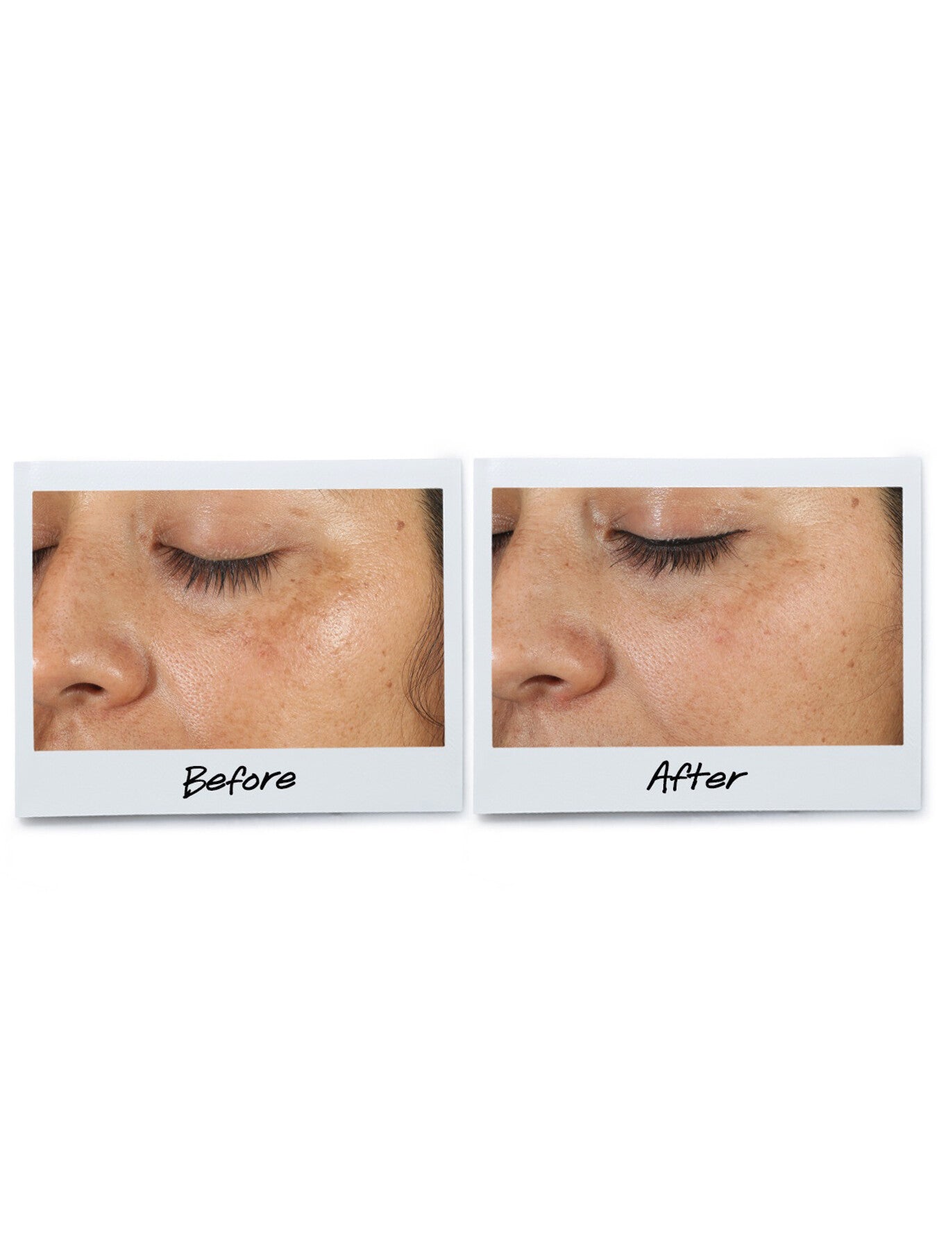 Clearly Corrective™ Dark Spot Solution 100ml