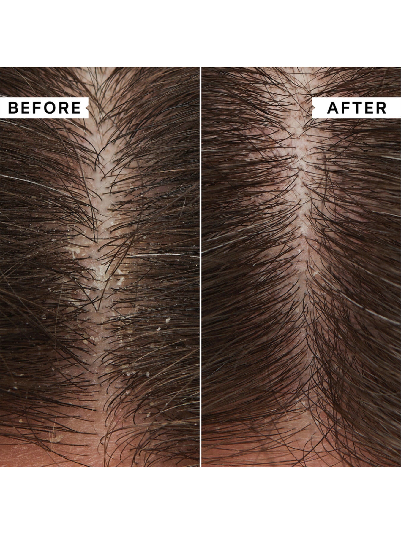 FlakyItchy Scalp Hydrating Conditioner 75ml