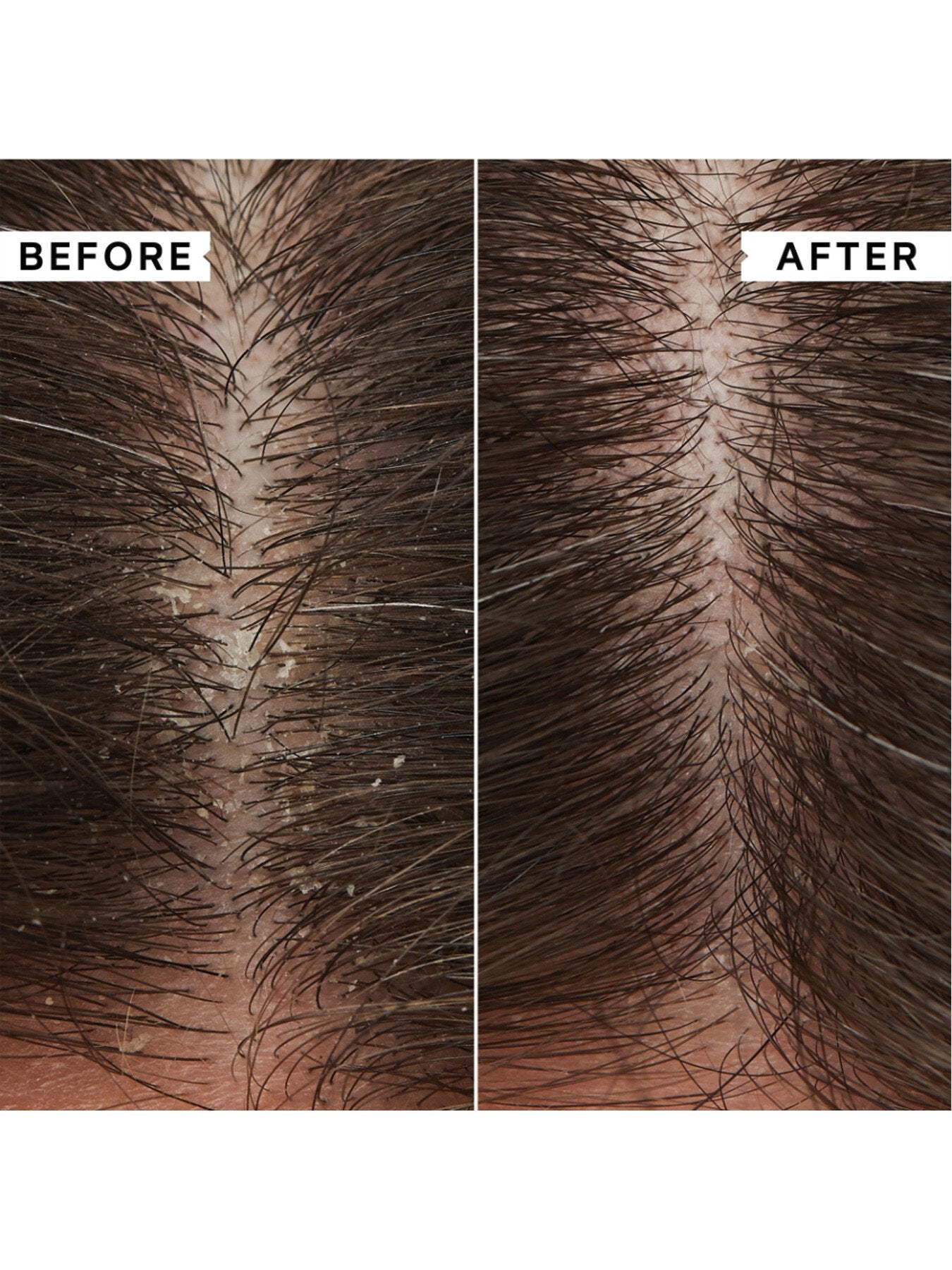 Flaky Itchy Scalp Hydrating Conditioner 200ml