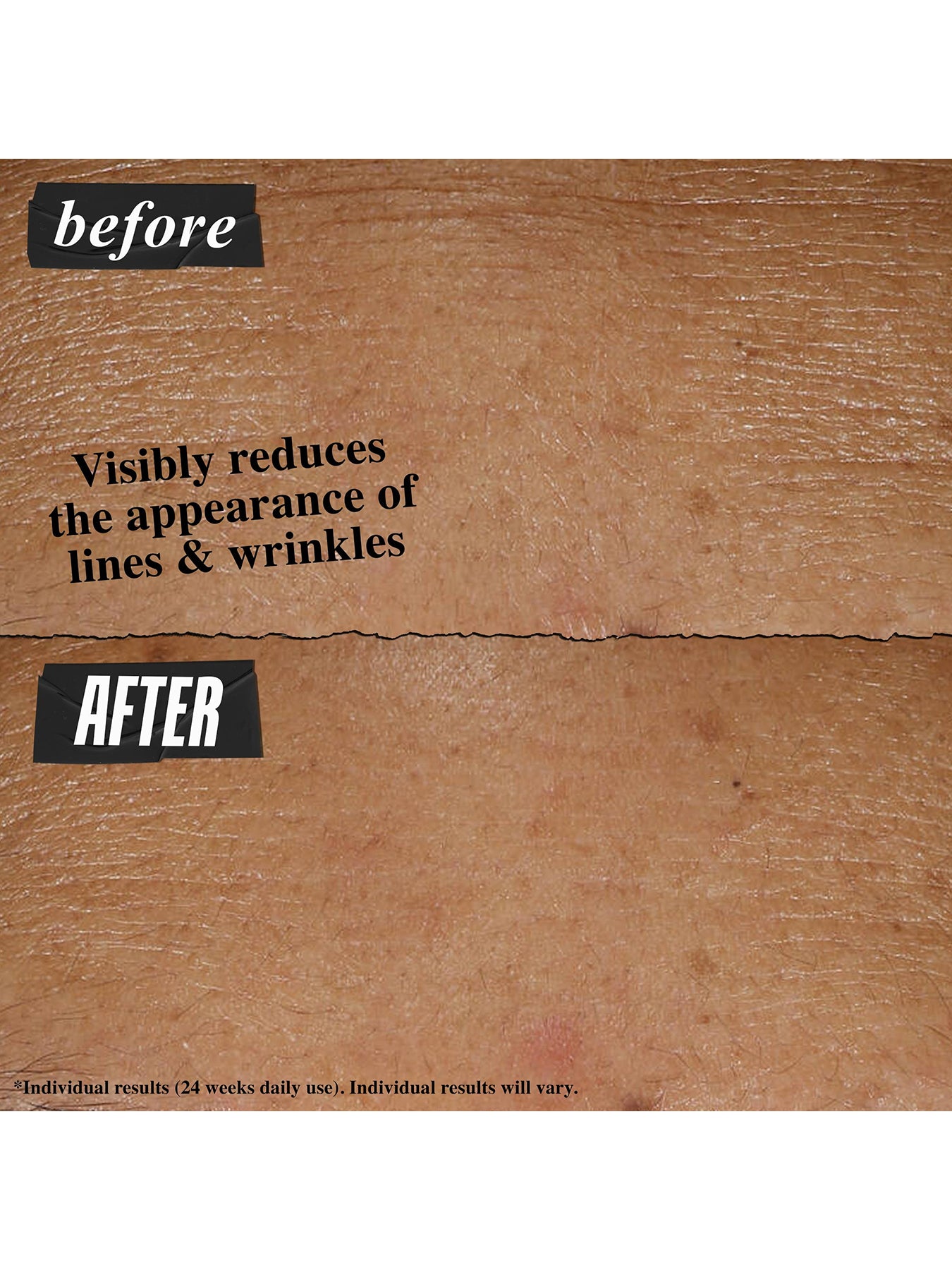 Retinol Skin Renewing Daily Micro-Dose Serum 50ml