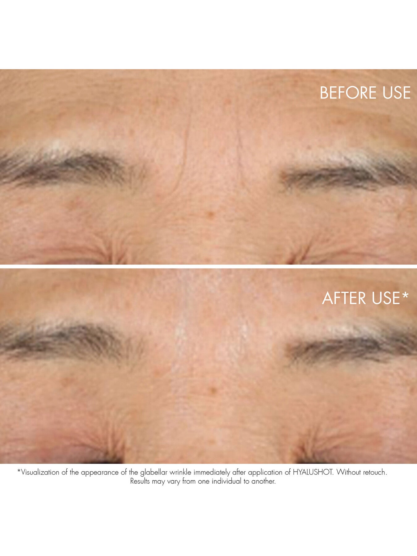 Capture Totale Hyalushot Concentre 15ml