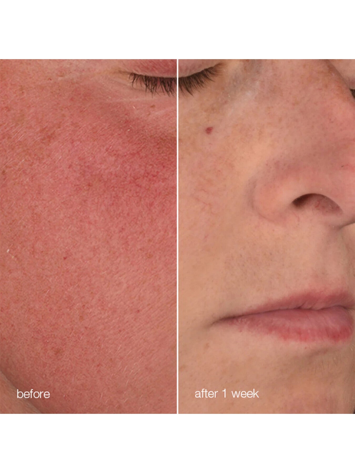 Stabilizing Repair Cream