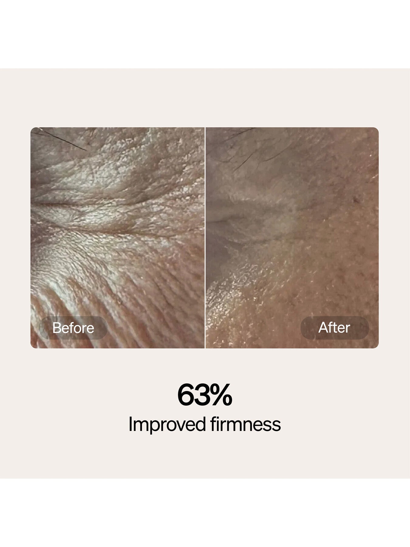 Lyma Skincare Serum And Cream Refills