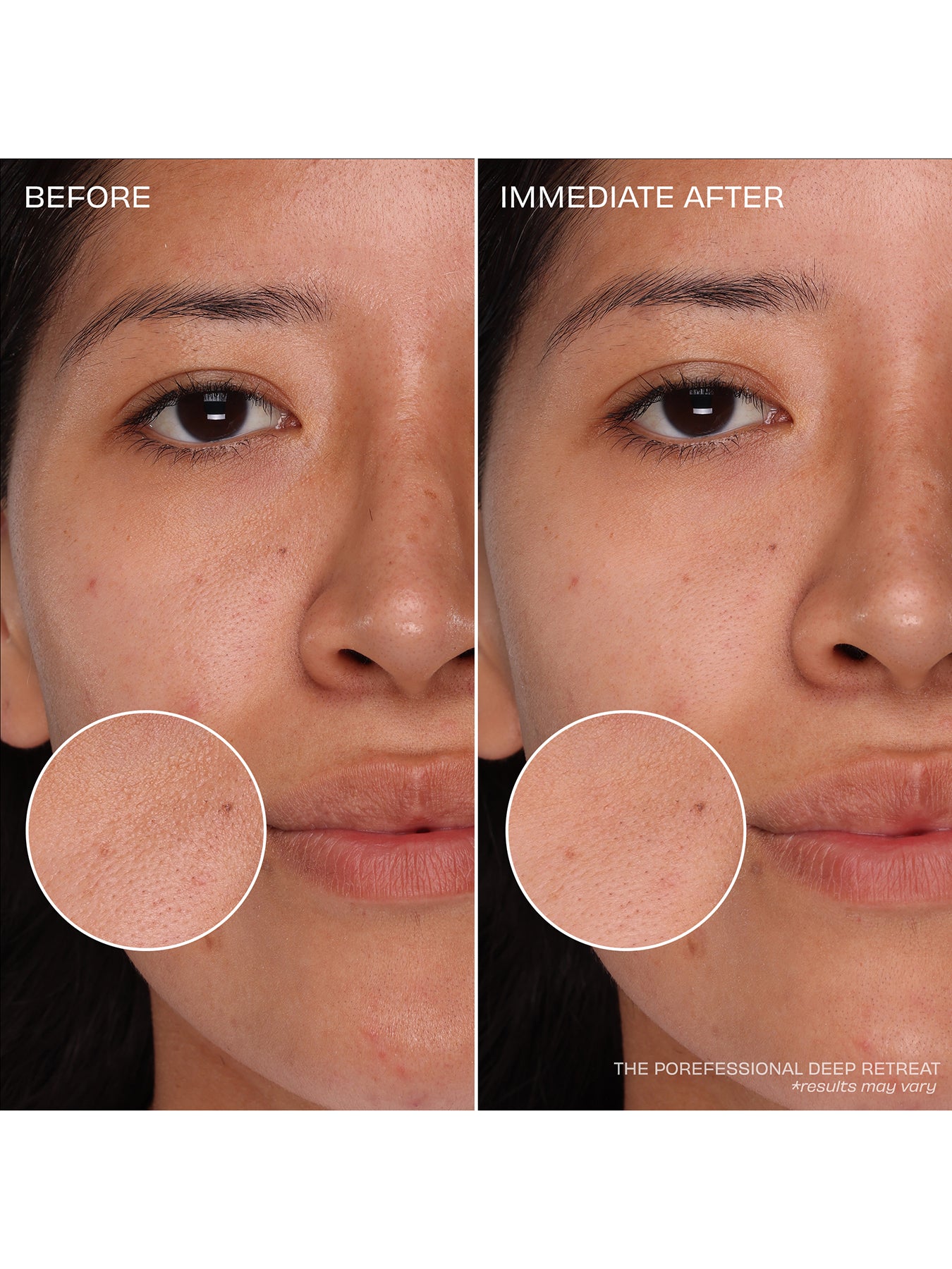 Pore Care Trial Set for Clear and Refined Skin