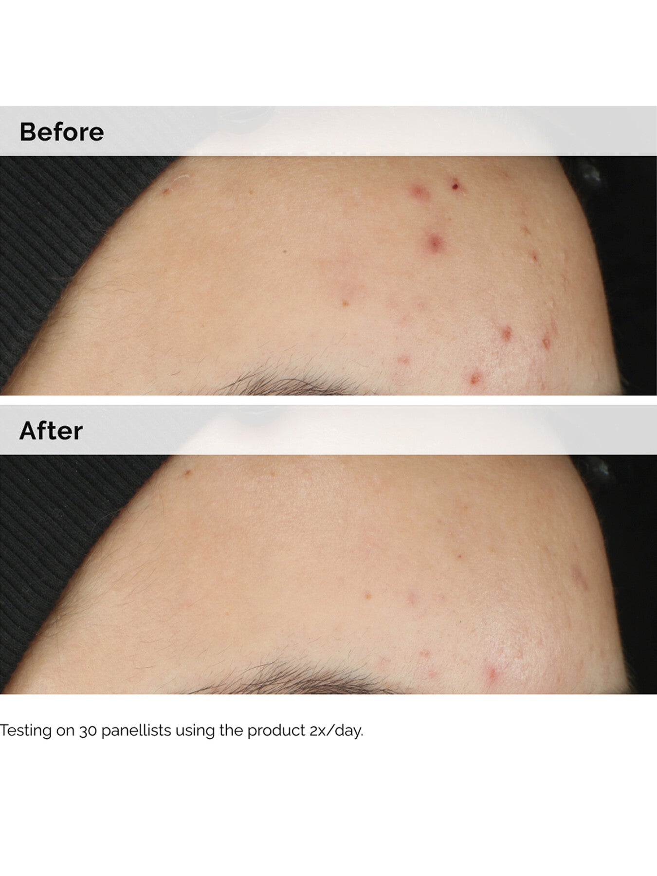 Balancing Clarifying Serum
