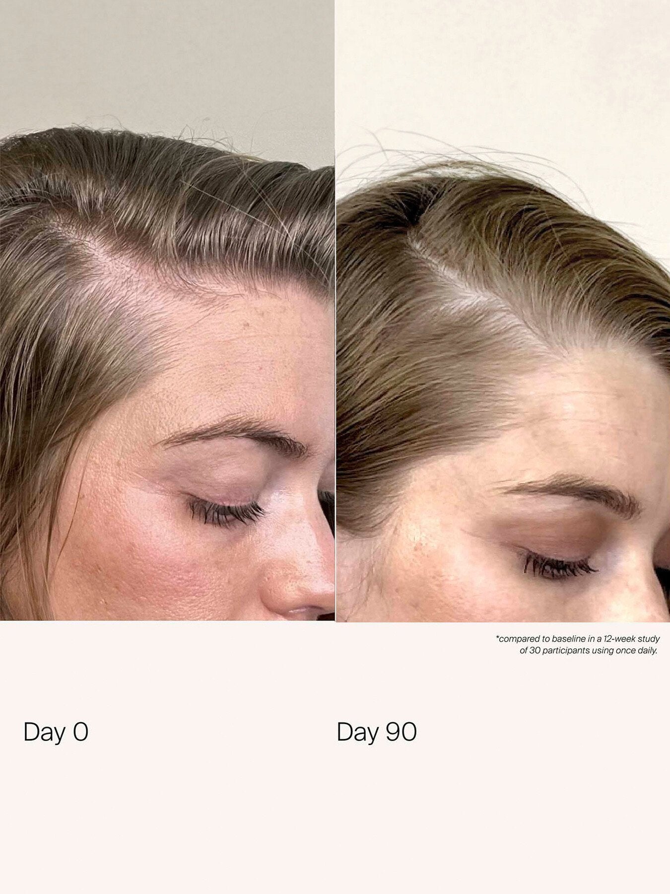 Scalp Care Density Serum 50ml