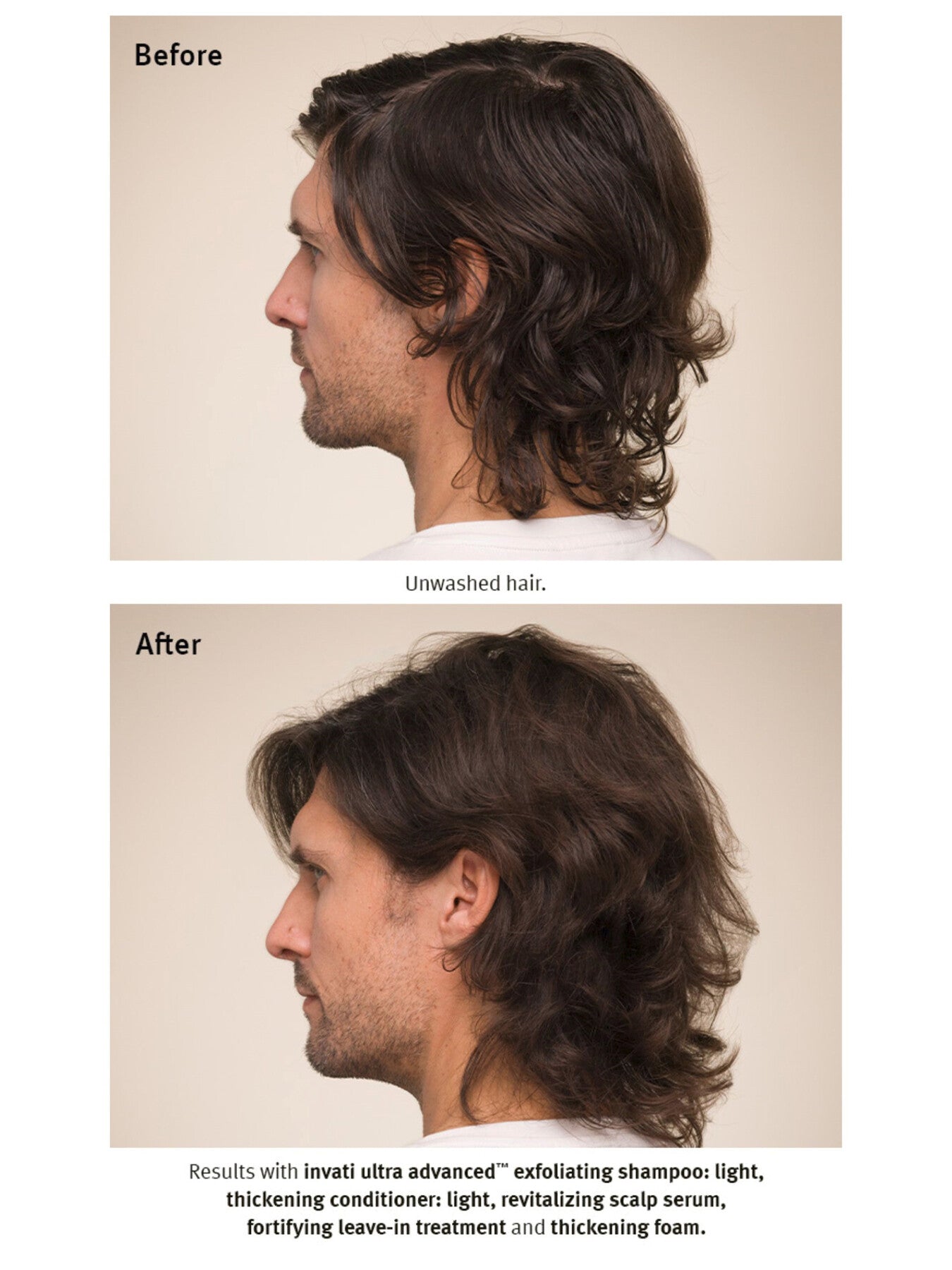 Invati Ultra Advanced™ Revitalizing Scalp Serum 30ml