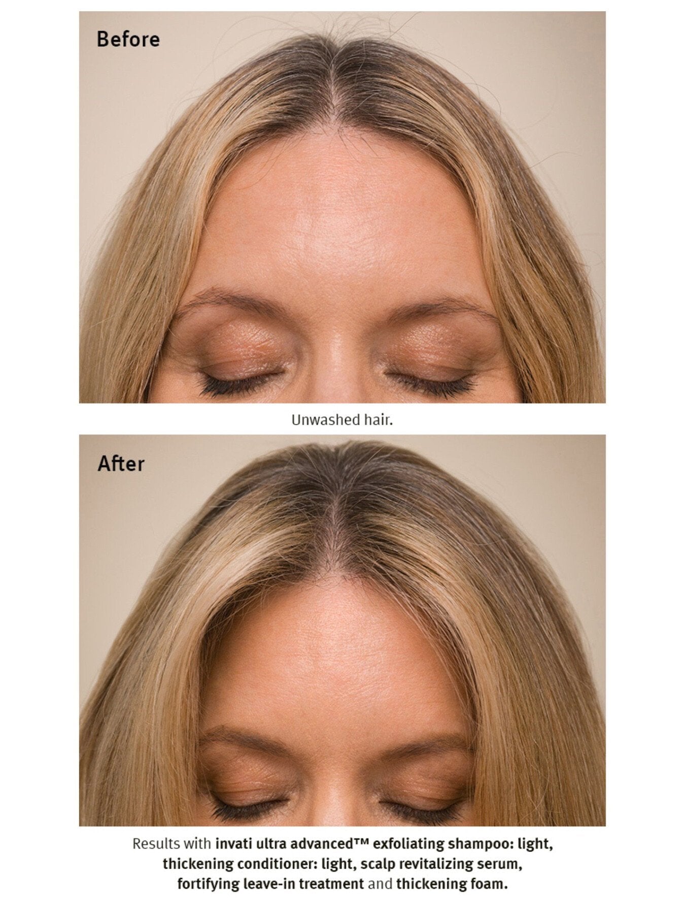 Invati Ultra Advanced™ Revitalizing Scalp Serum 150ml