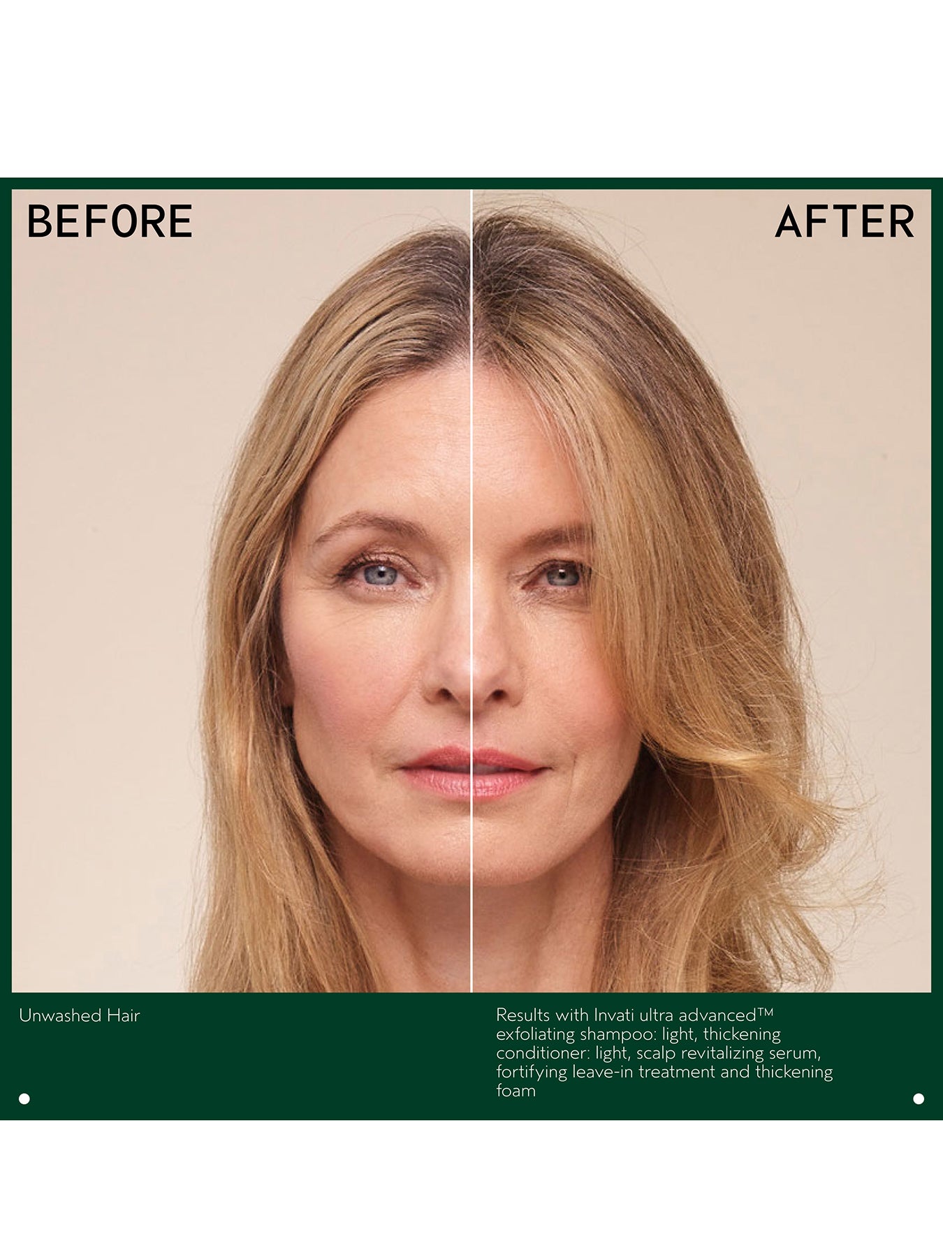 Invati Ultra Advanced™ Fortifying Leave-in Treatment 100ml
