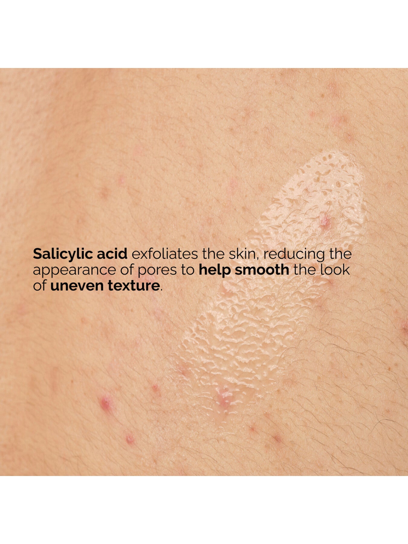 Salicylic Acid 0.5 Body Serum 240ml