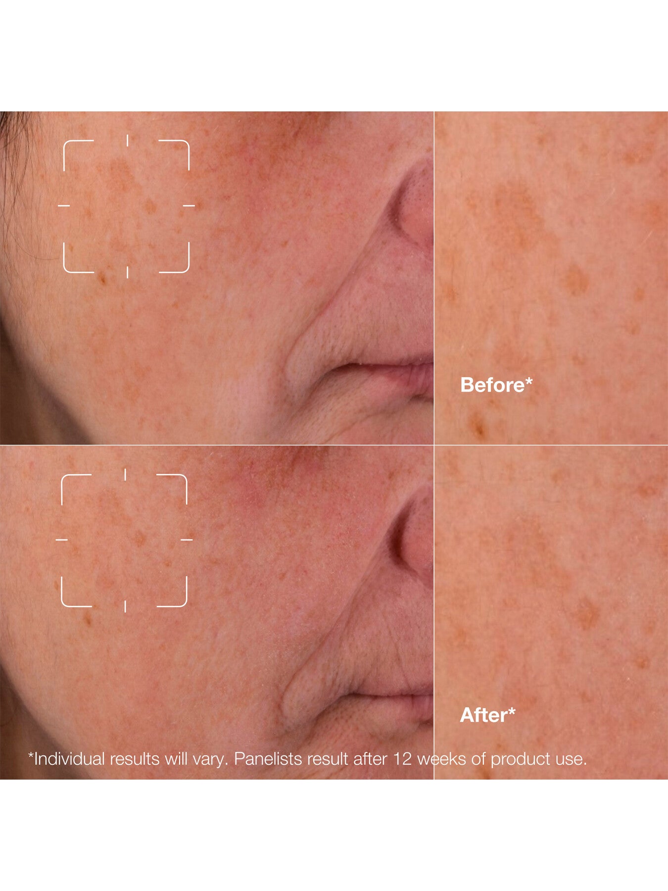 Even Better Clinical™ Dark Spot Clearing Serum 50ml