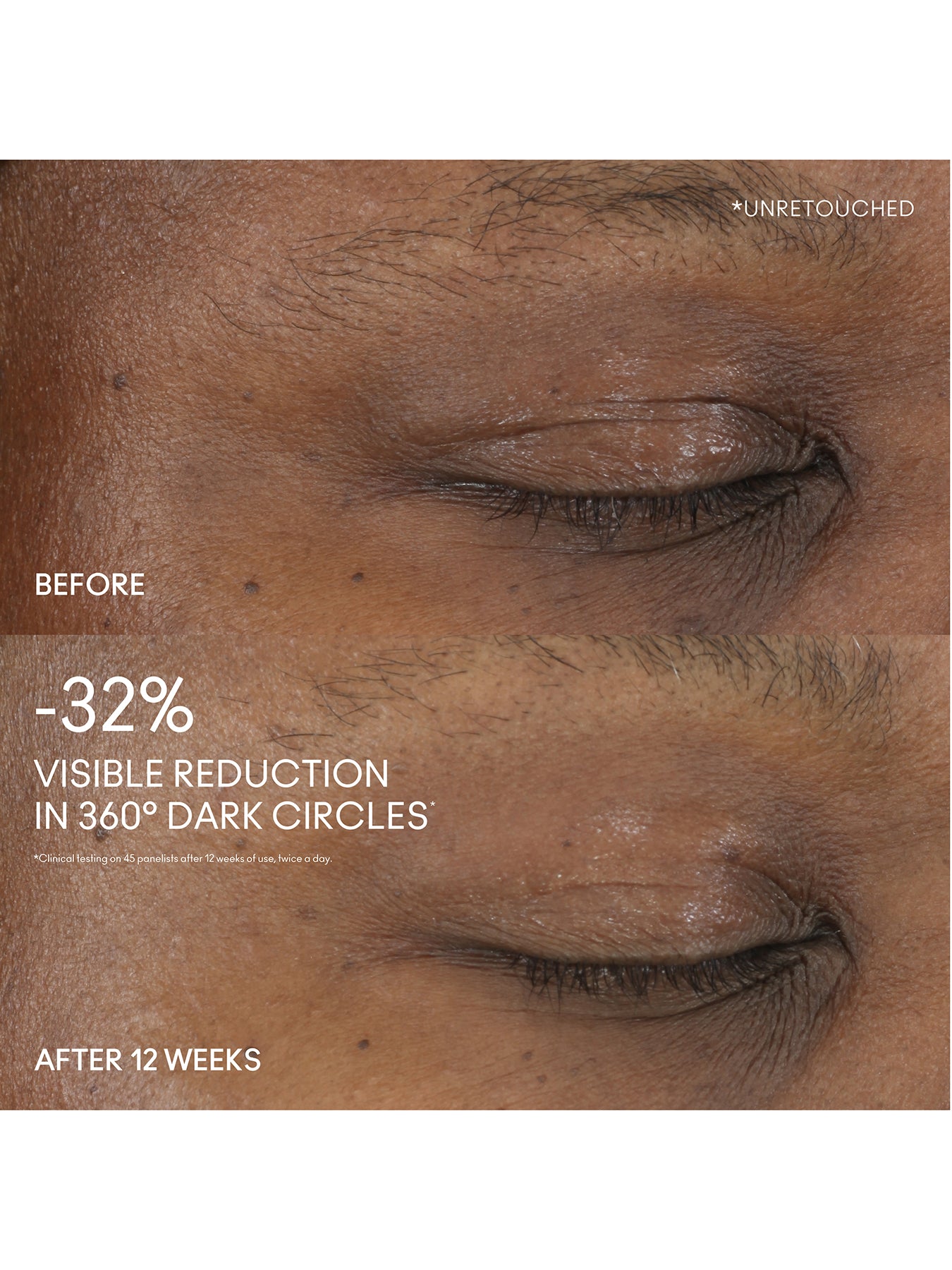 Hyper Real Serumizer Eye