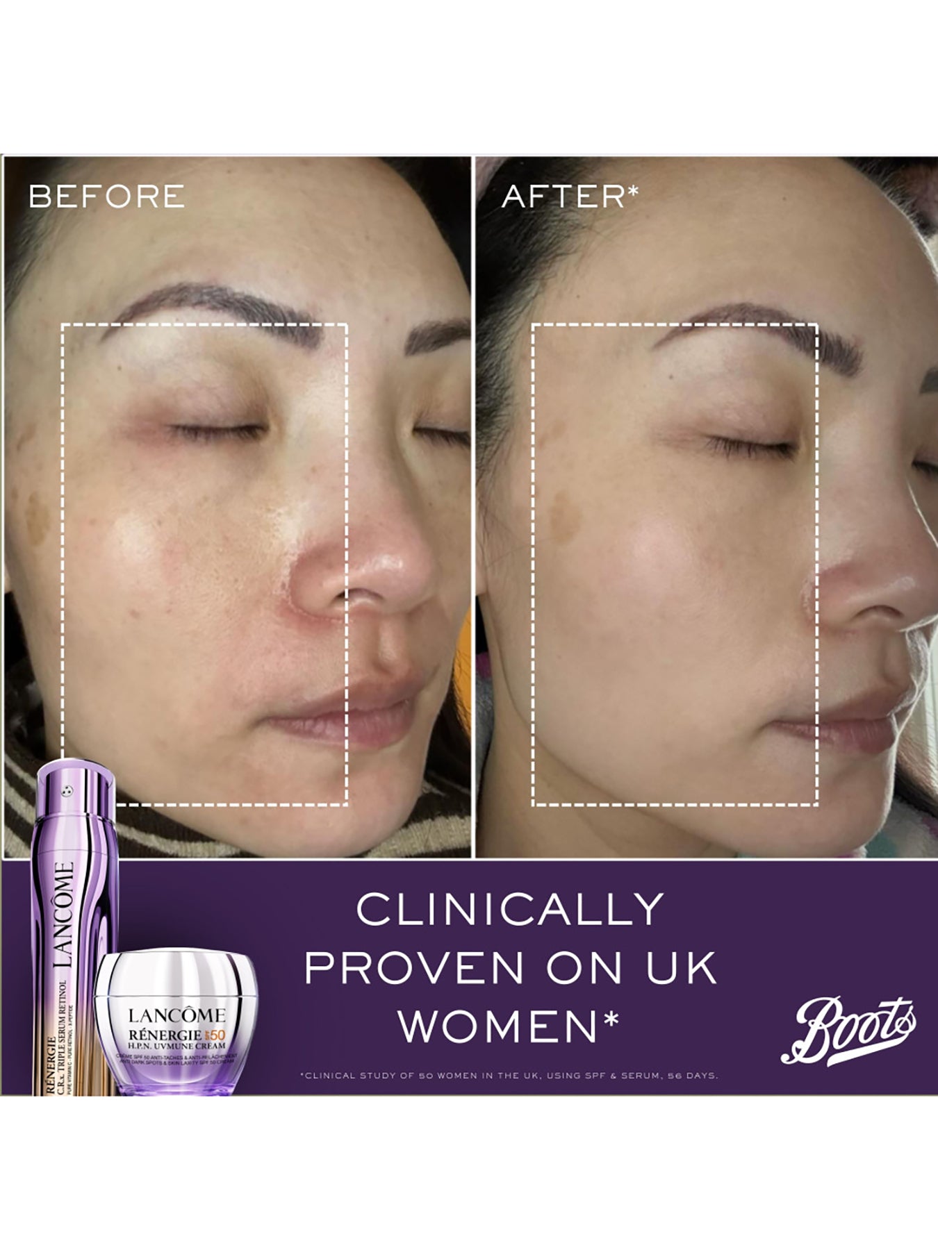 Regenerie Triple Serum Set