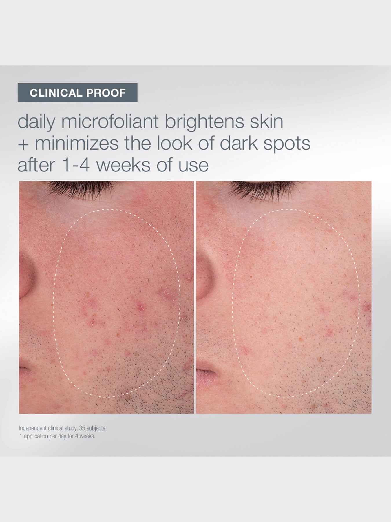 Warmth of the Winter Sun Skincare Set