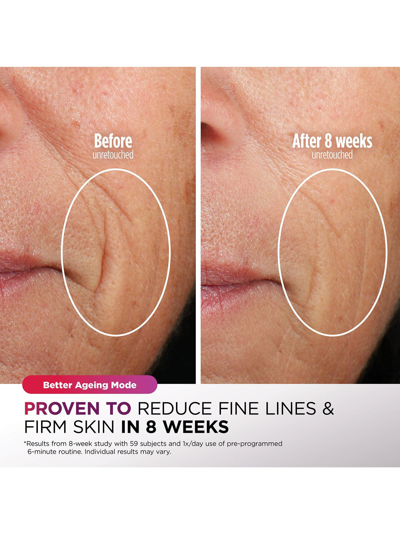 CryoGlow Under Eye Cooling LED Mask