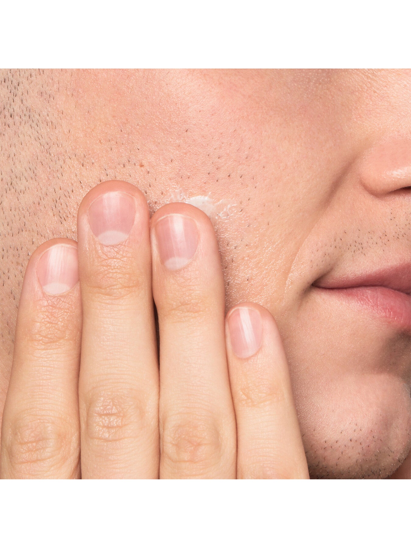 Ultimate Razor Burn Bump Relief 75ml