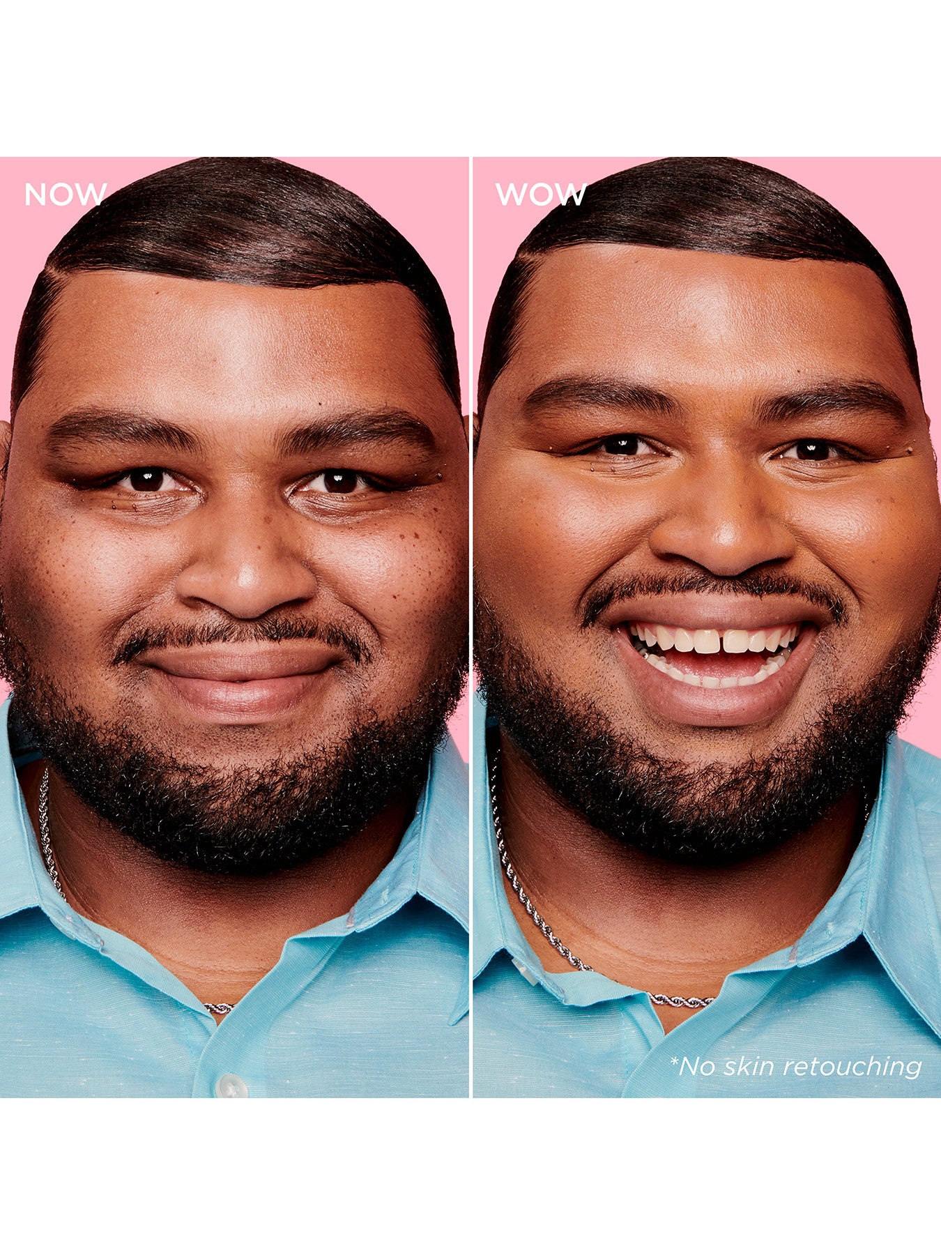 Boi-ing Cakeless Concealer