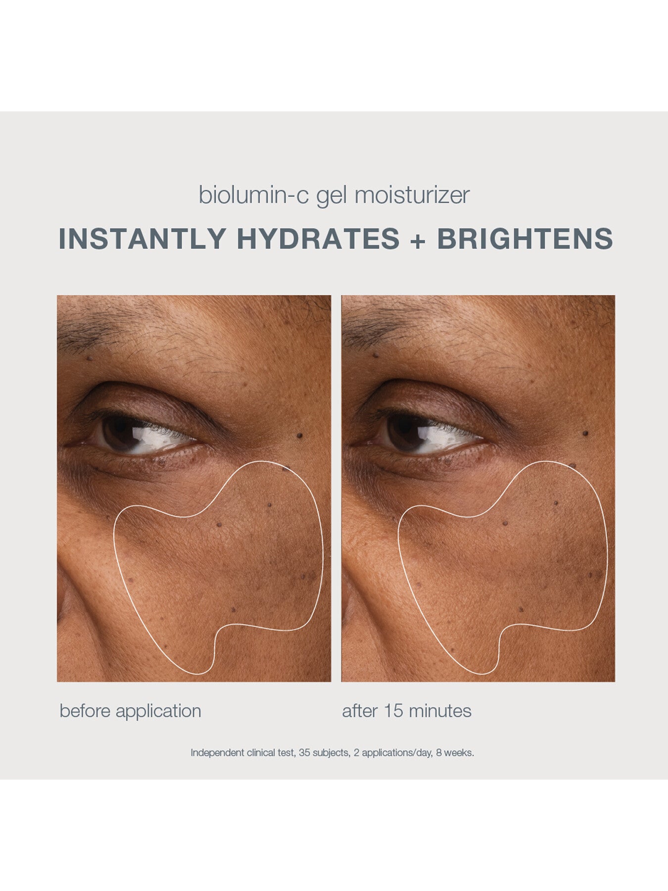 Biolumin C Gel Moisturizer