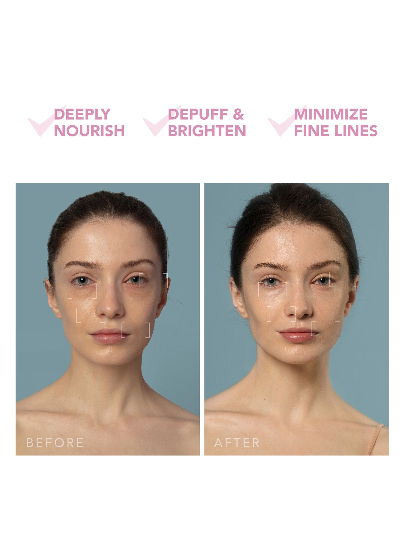 UFO™ 3 5-in-1 Deep Facial Hydration Skin Wellness Device