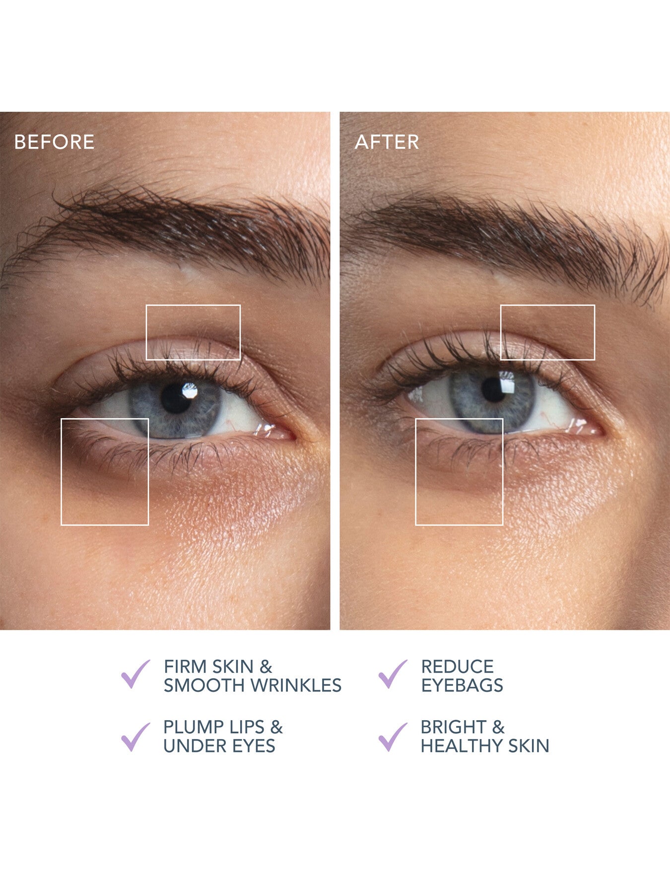 BEAR™ 2 eyes lips Microcurrent Line Smoothing Device