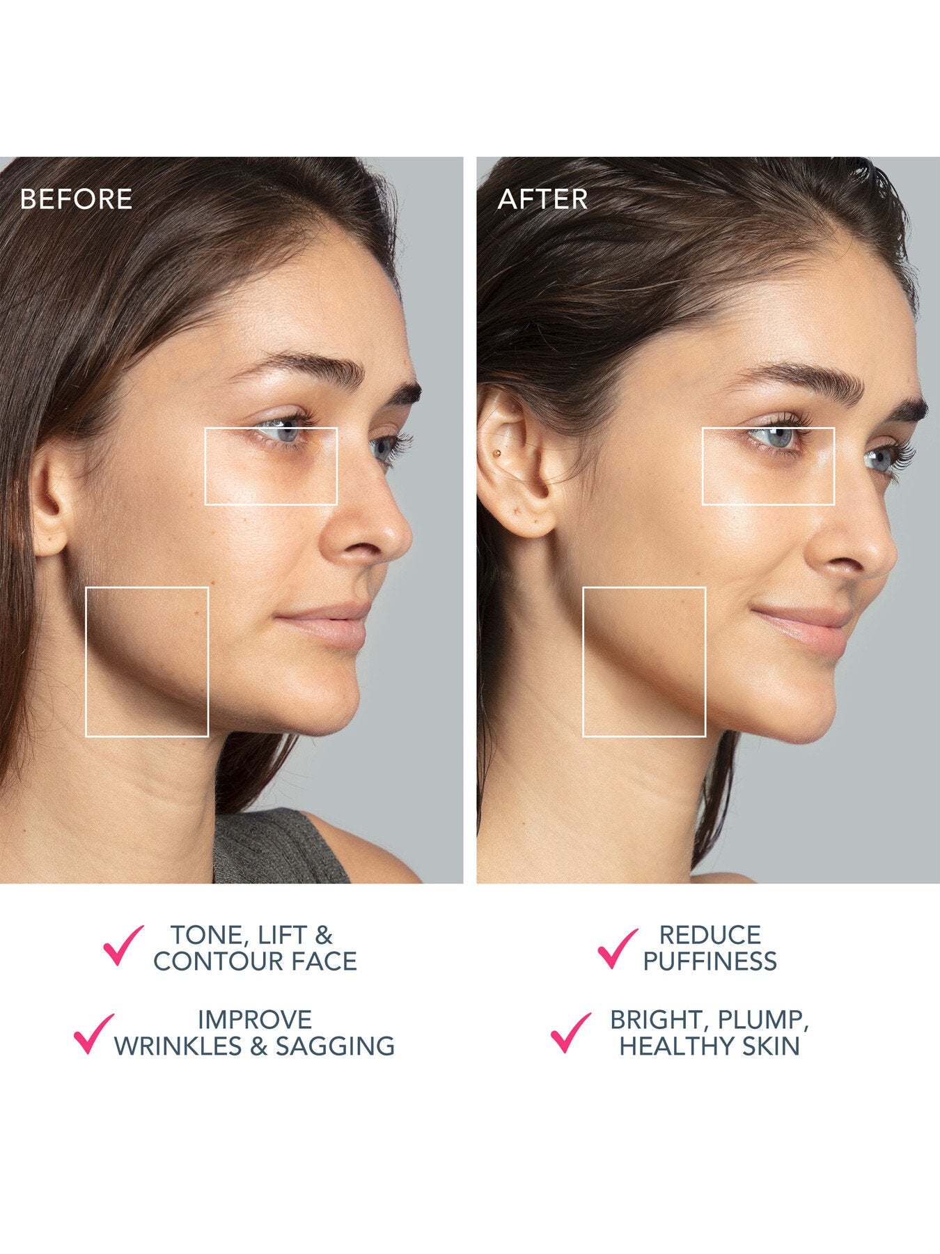 BEAR™ 2 Advanced Microcurrent Full-Facial Toning Device