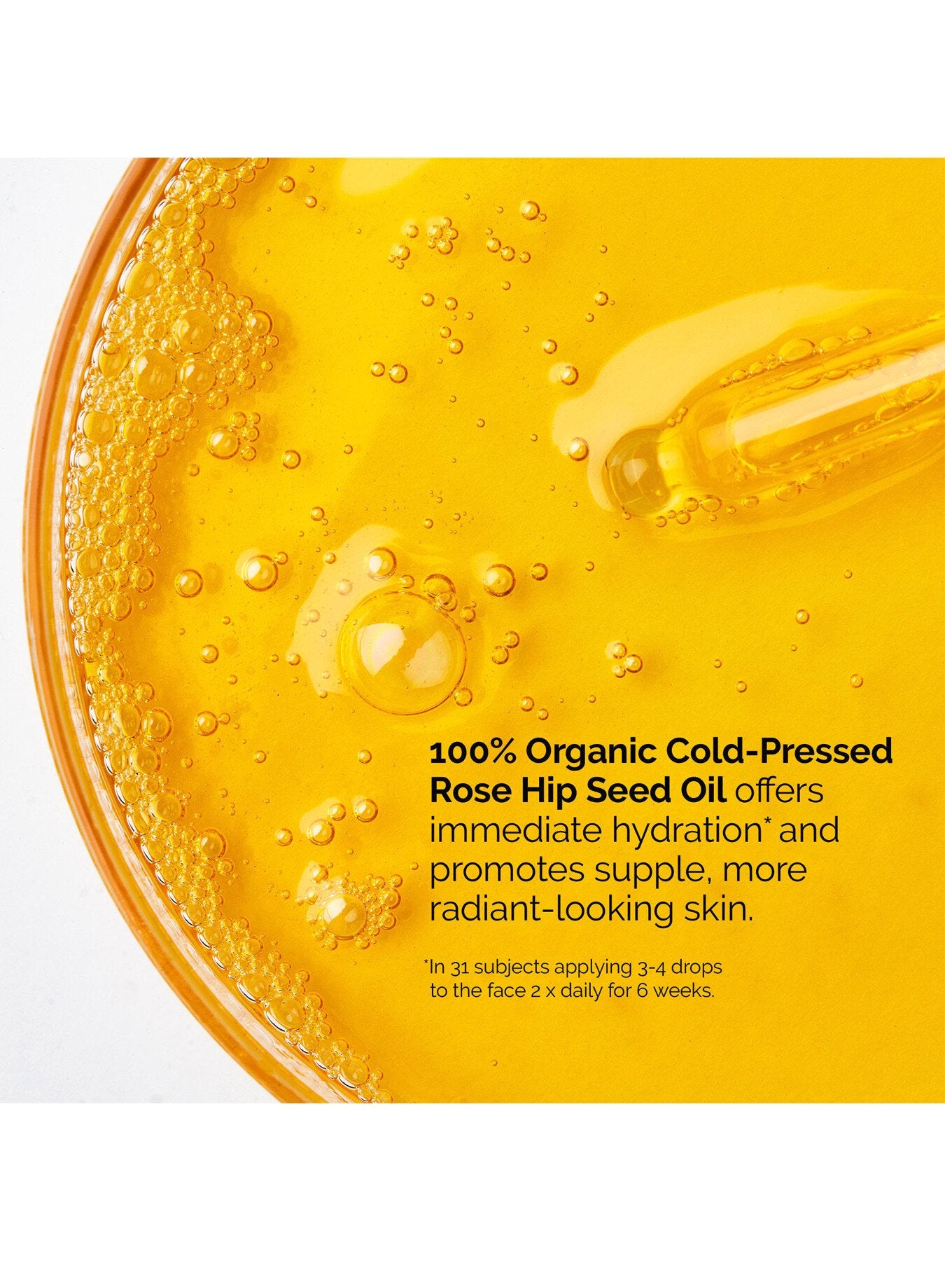 100 Organic Cold-Pressed Rose Hip Oil