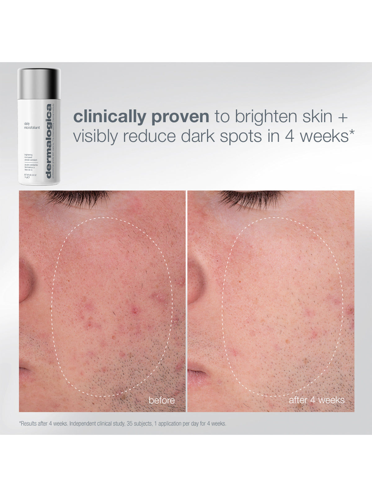 Pro Ritual: Exfoliate & Glow Gift Set