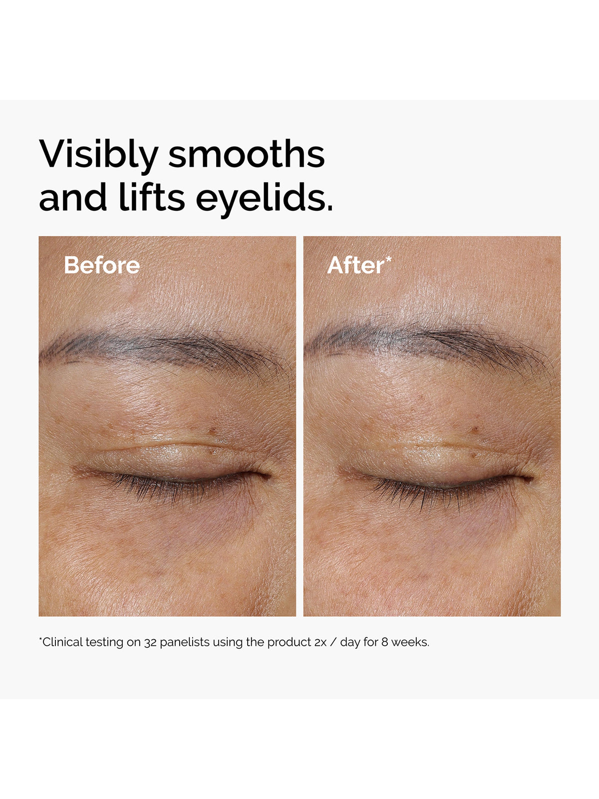 Lacto-PDRN™ 4% + B9 Lifting & Tightening Eye Cream