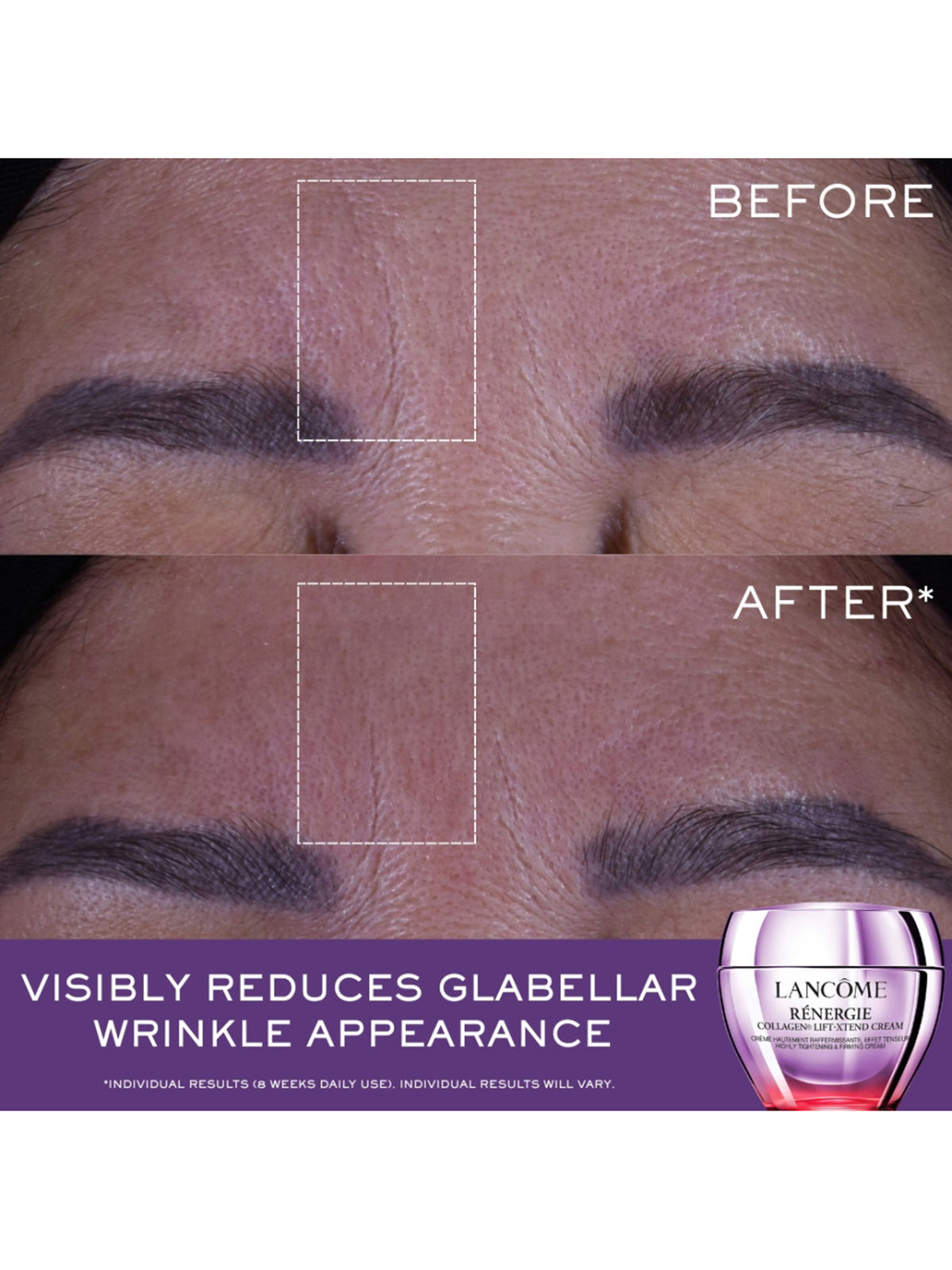 Rénergie Collagen Lift-Xtend Cream 30ml