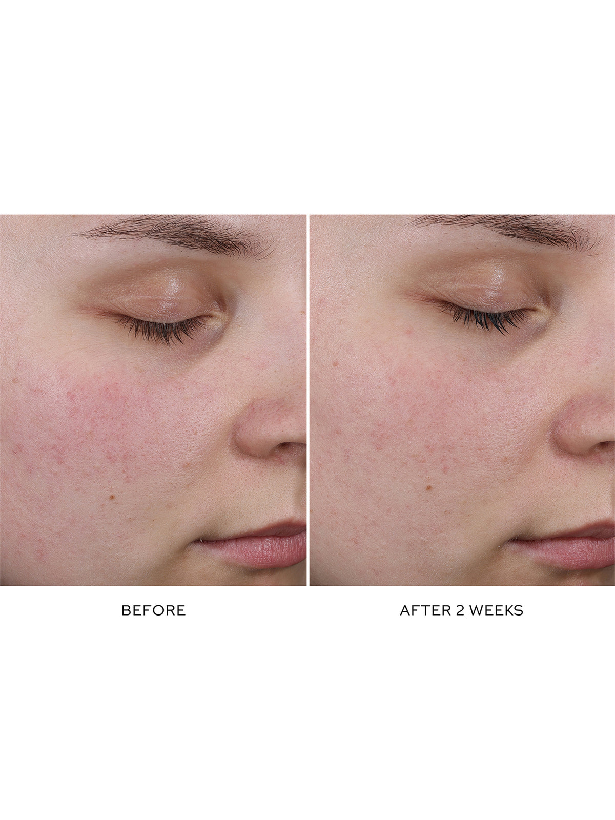 Pore Refining Complex 15ml