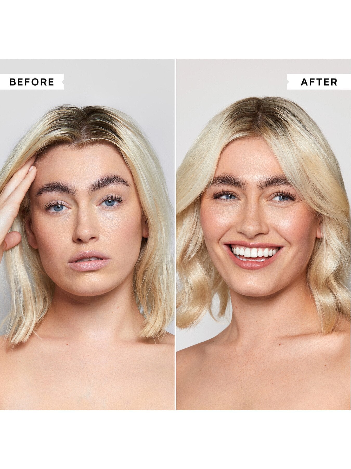 FlakyItchy Scalp Anti-Dandruff Scalp Toner 250 ml