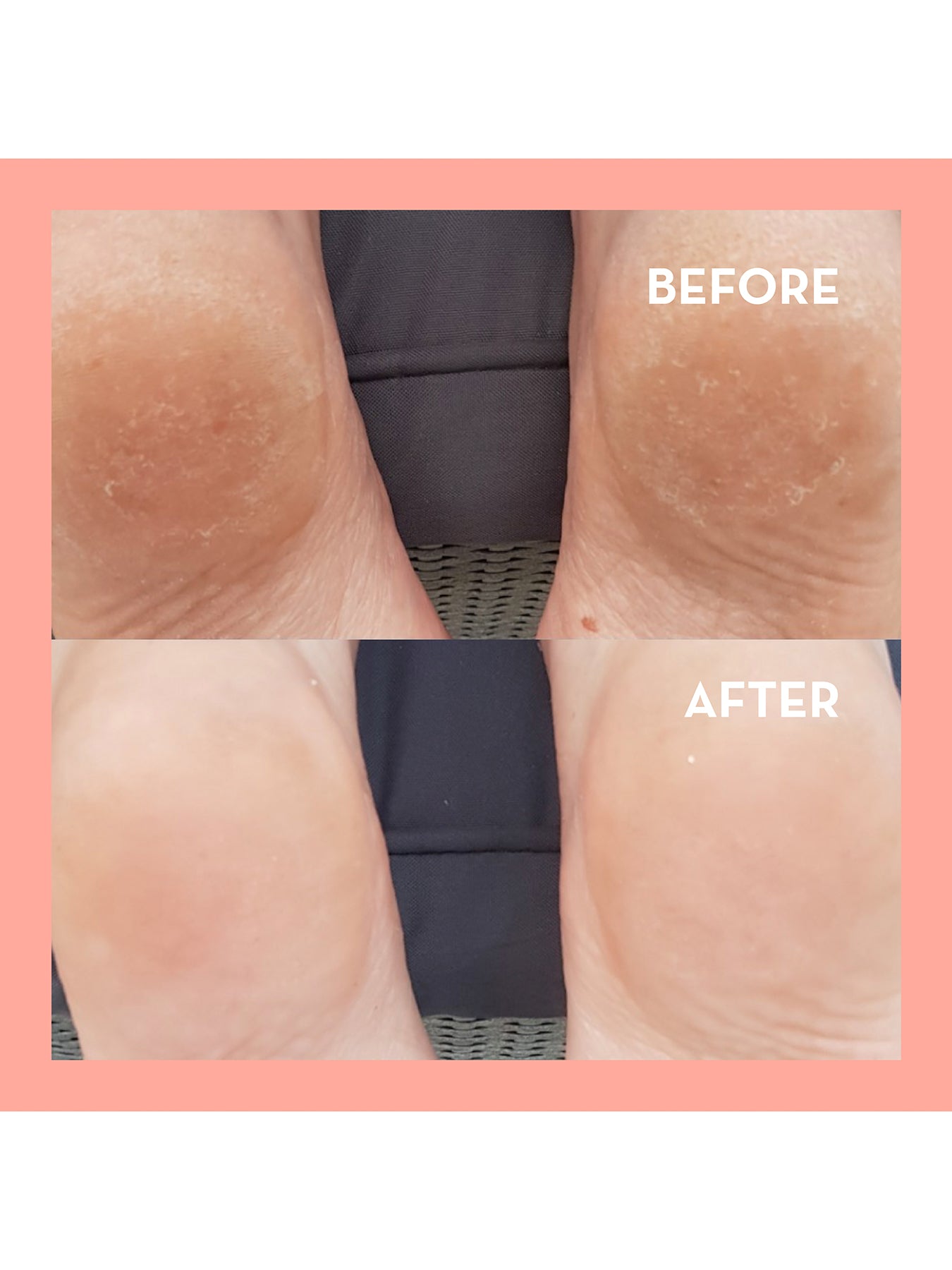 Rosy Toes Instant Pedicure
