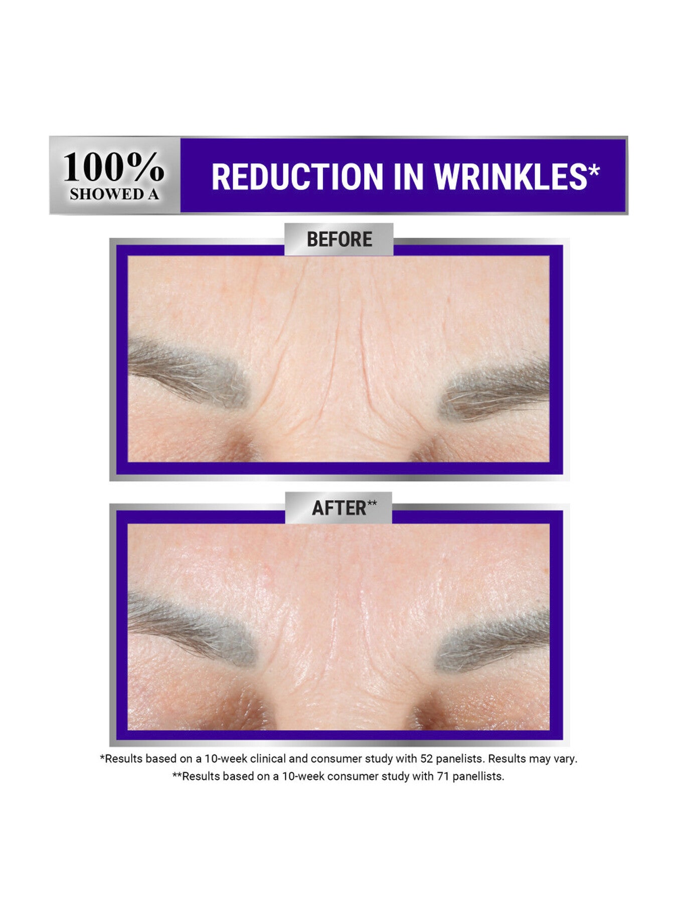 Fast Release Retinol Serum 30ml