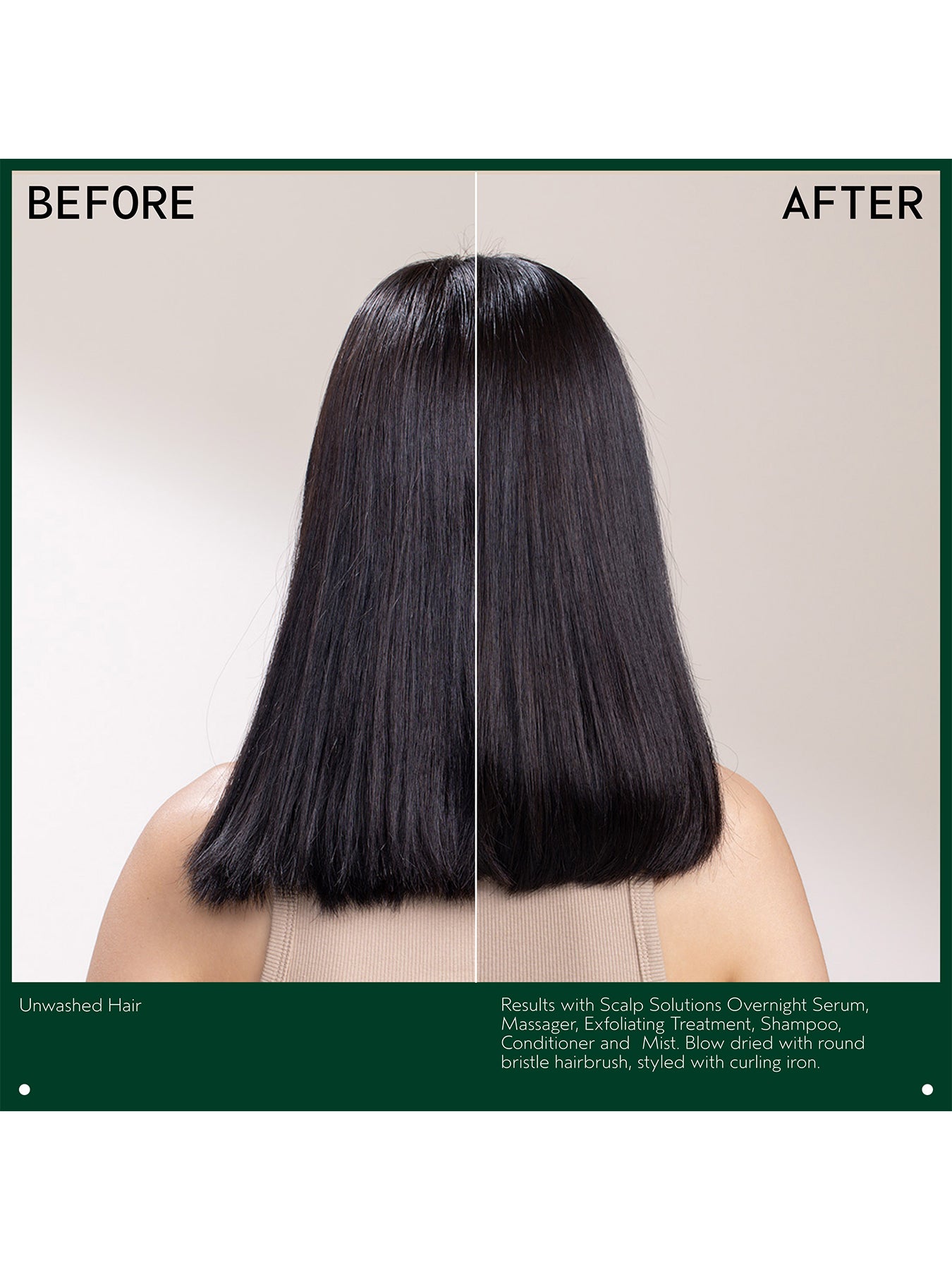 Scalp Solutions Stimulating Scalp Massager