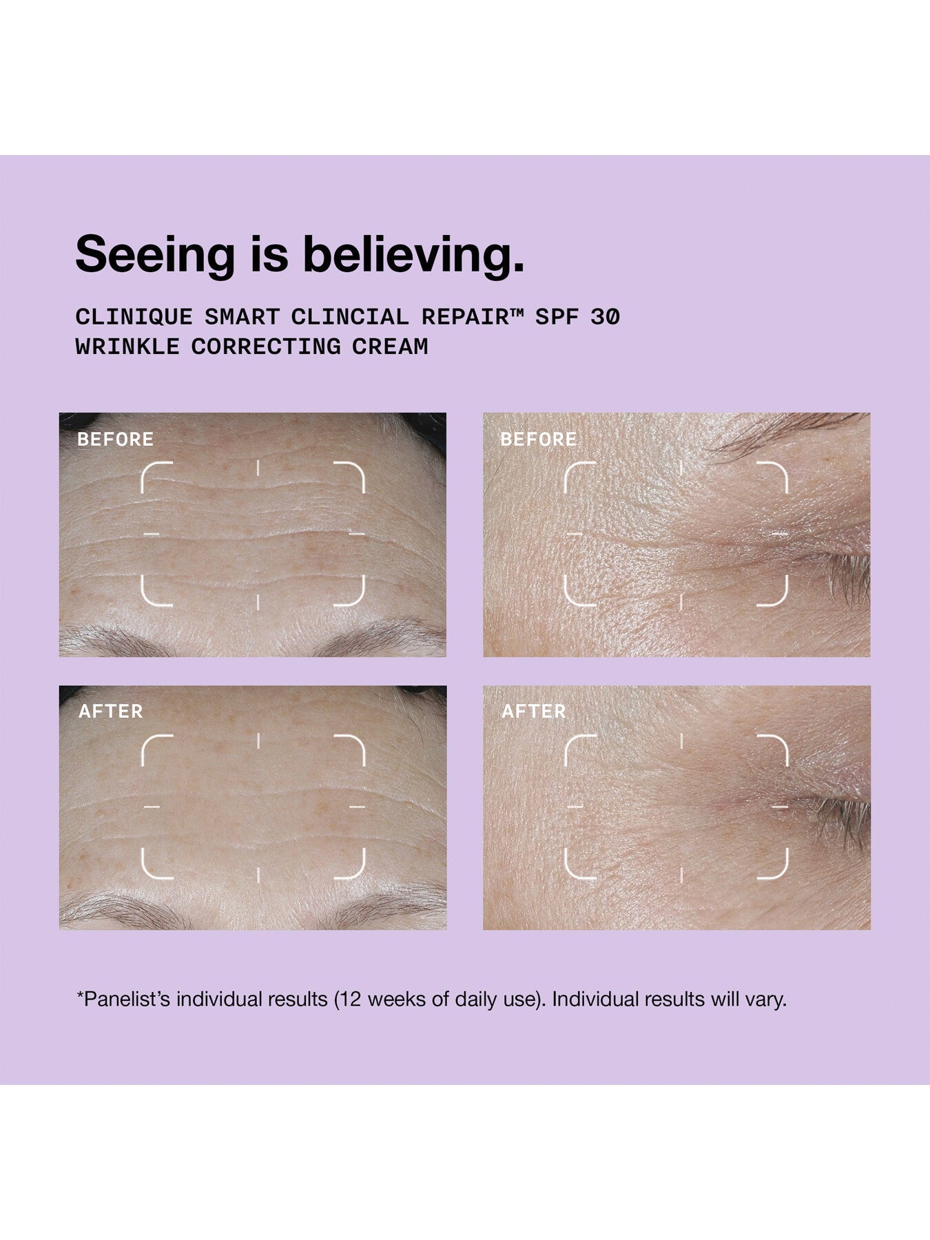 Clinique Smart Clinical Repair SPF 30 Wrinkle Correcting Cream 50ml