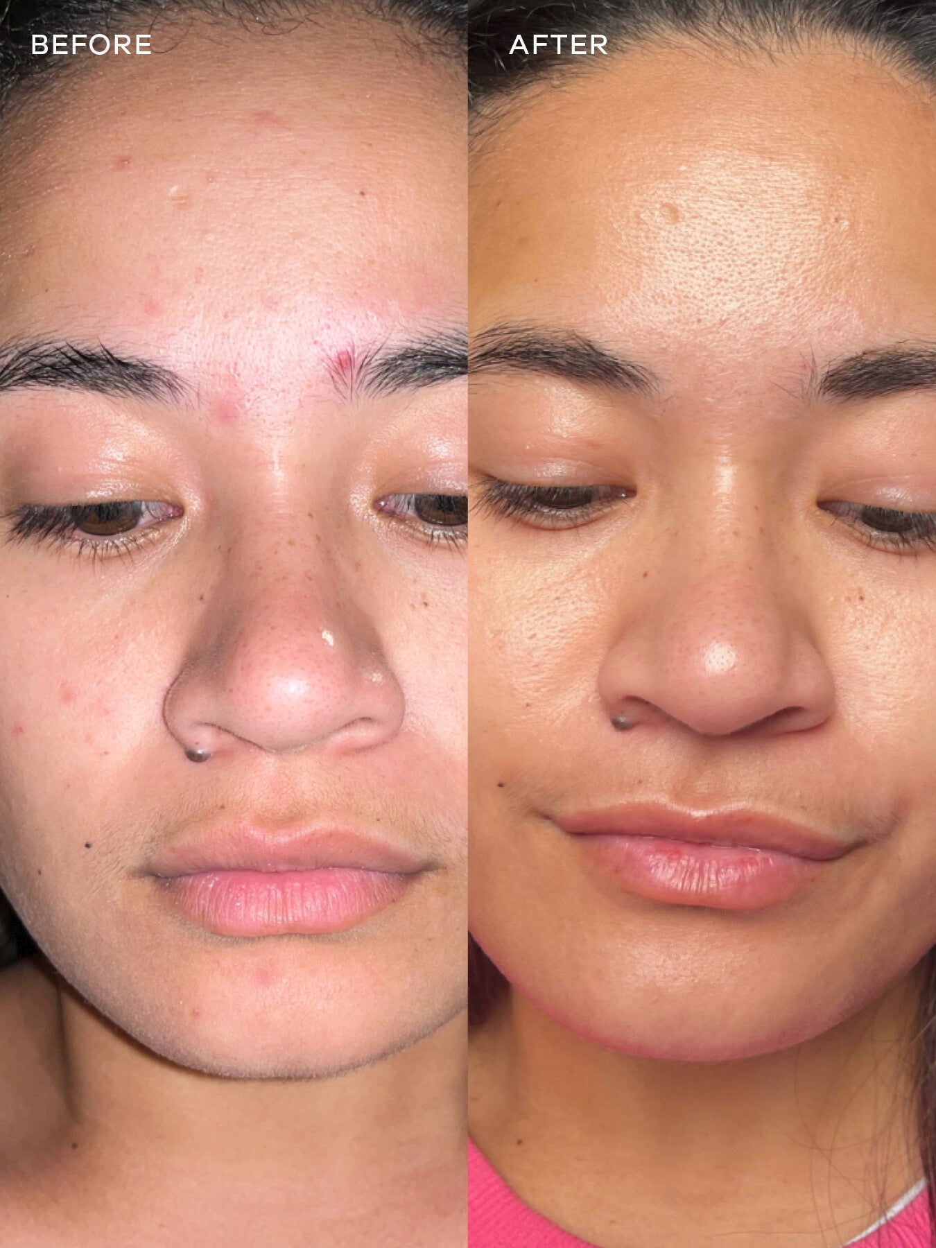 Anti G Ox Berry Sachets