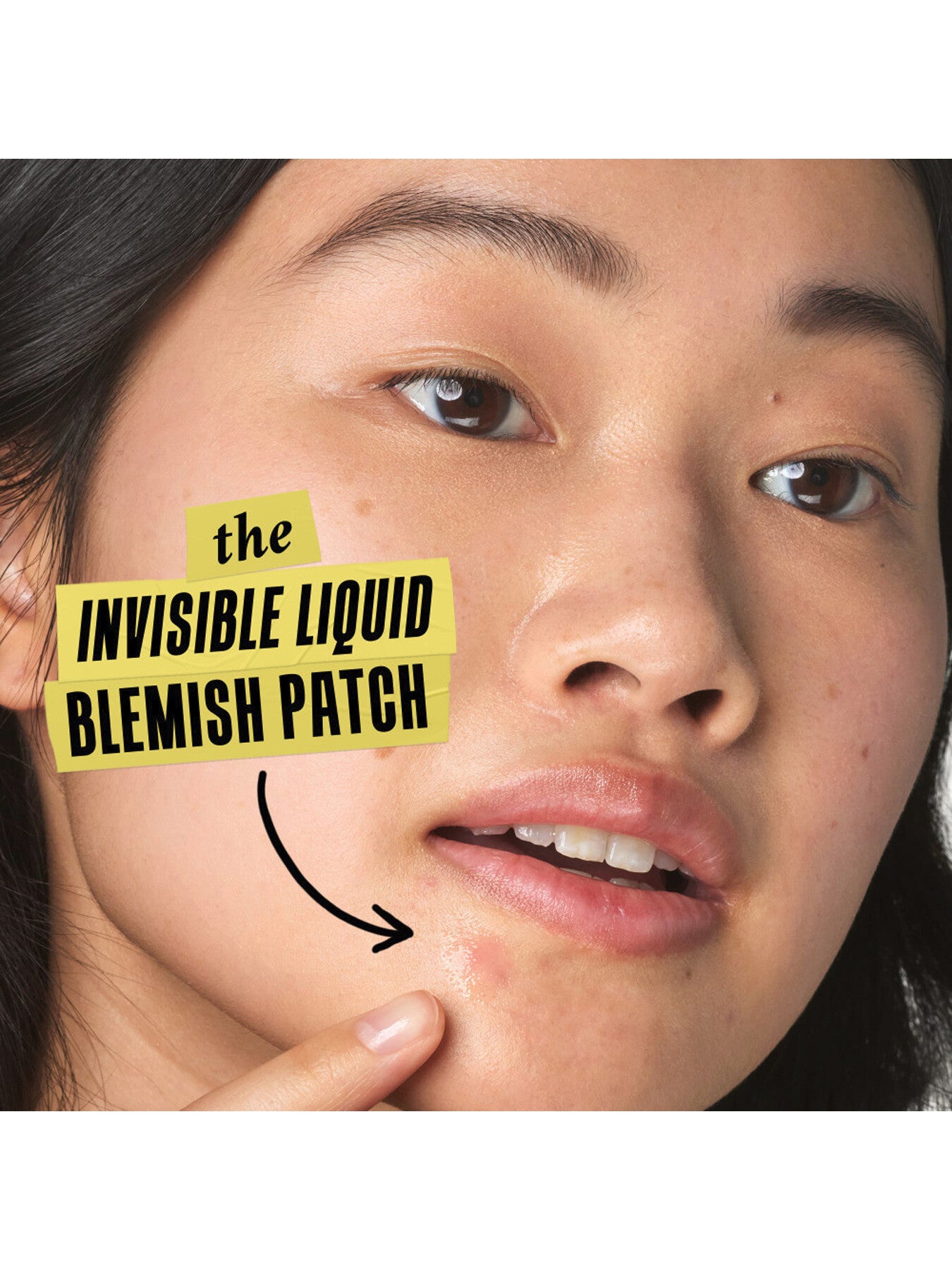 Kiehls Truly Targeted Blemish-Clearing Solution 15ml