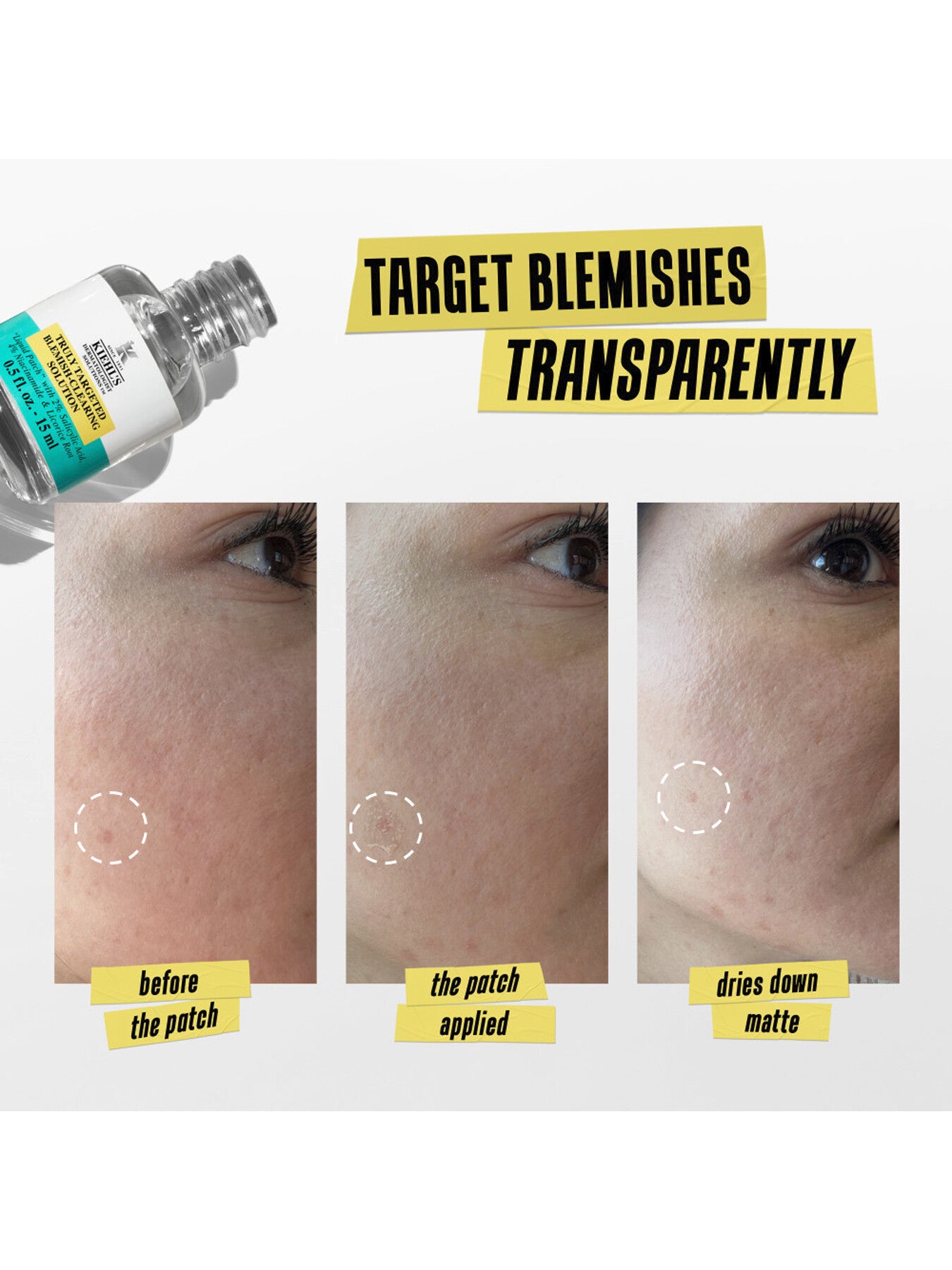 Kiehls Truly Targeted Blemish-Clearing Solution 15ml
