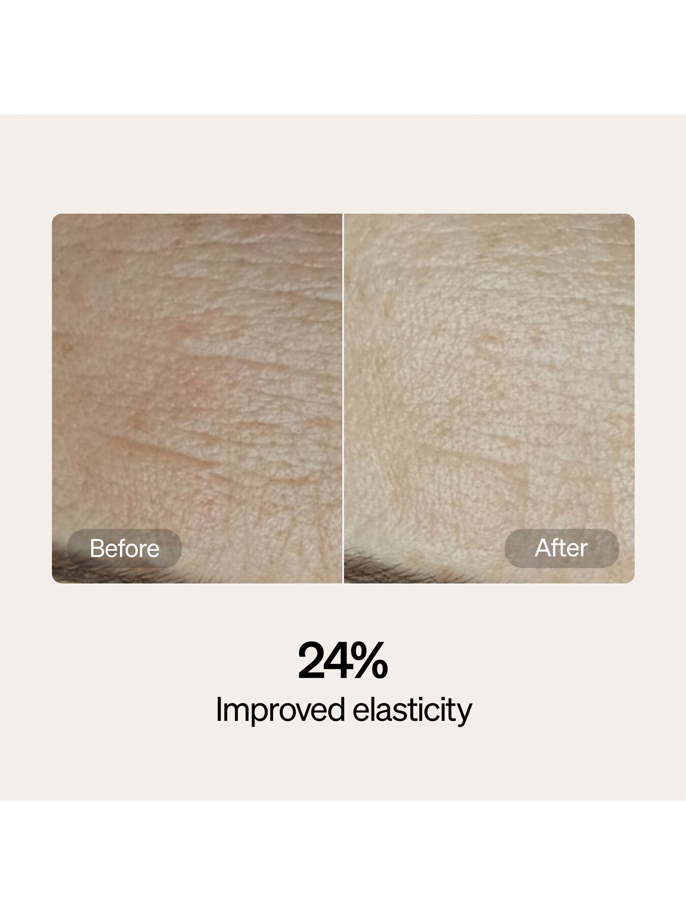 Lyma Skincare Serum And Cream Starter Kit