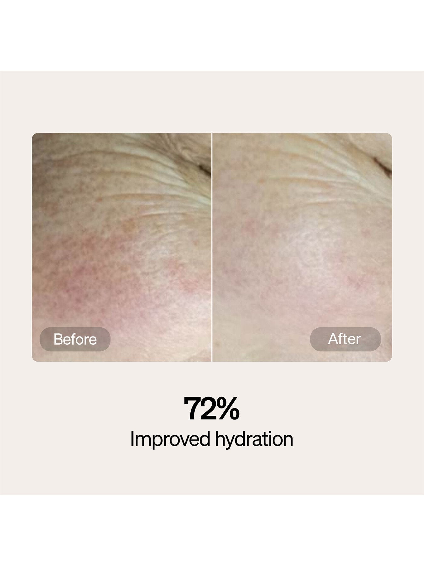 Lyma Skincare Serum And Cream Refills