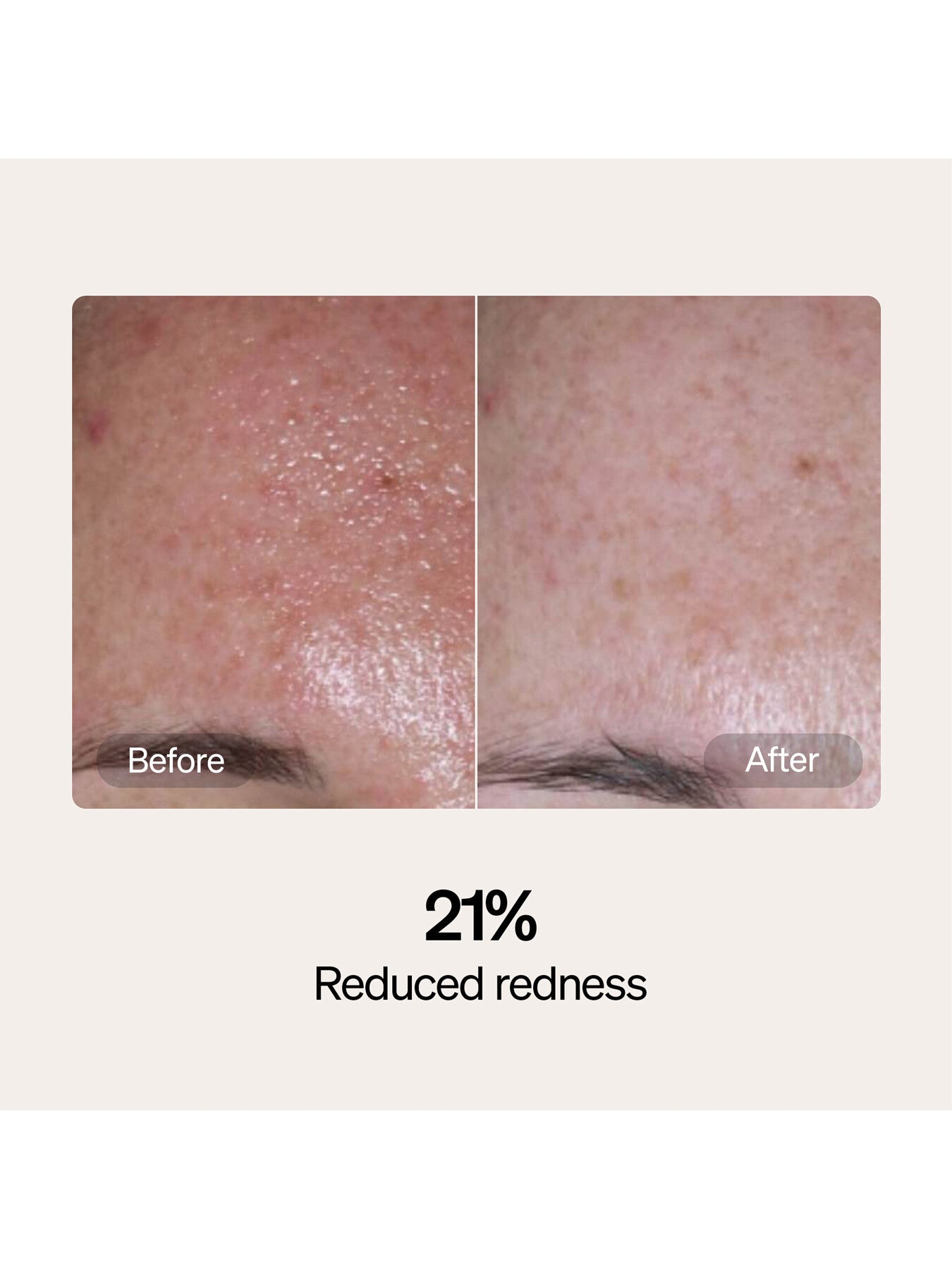 Lyma Skincare Serum And Cream Refills