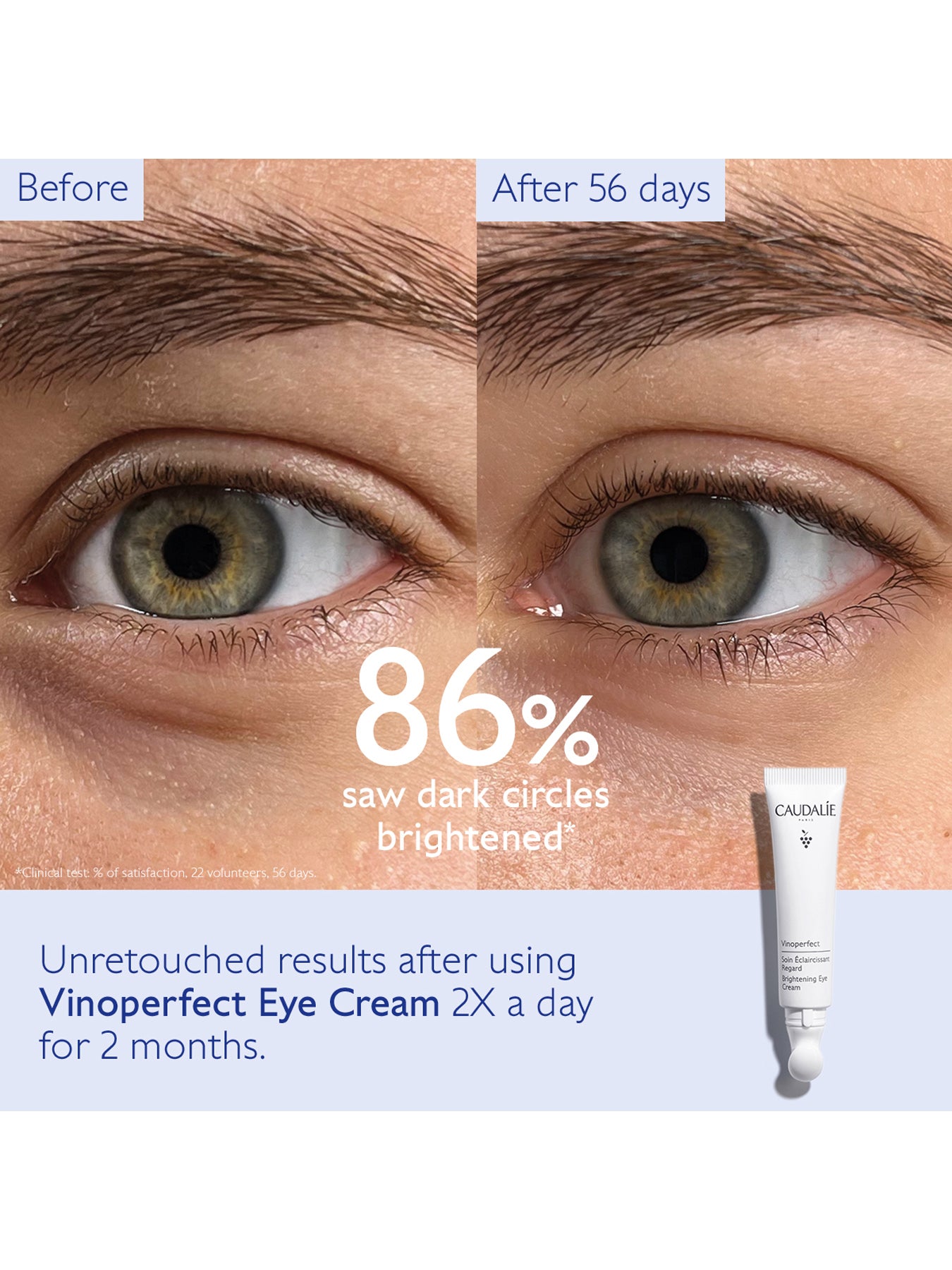 Vinoperfect Brightening Eye Cream with Niacinamide 15ml
