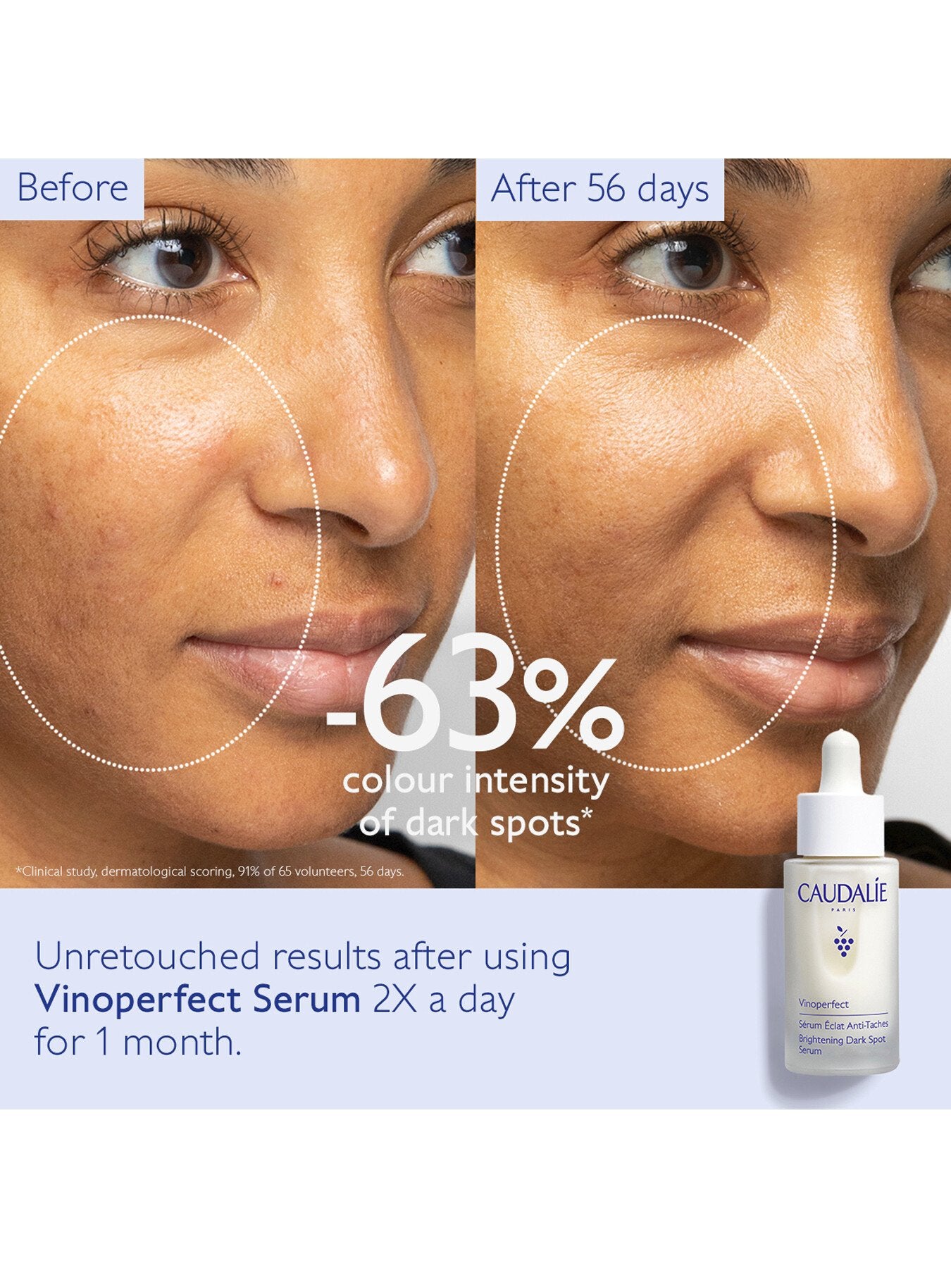 Vinoperfect Brightening Dark Spot Serum 30ml