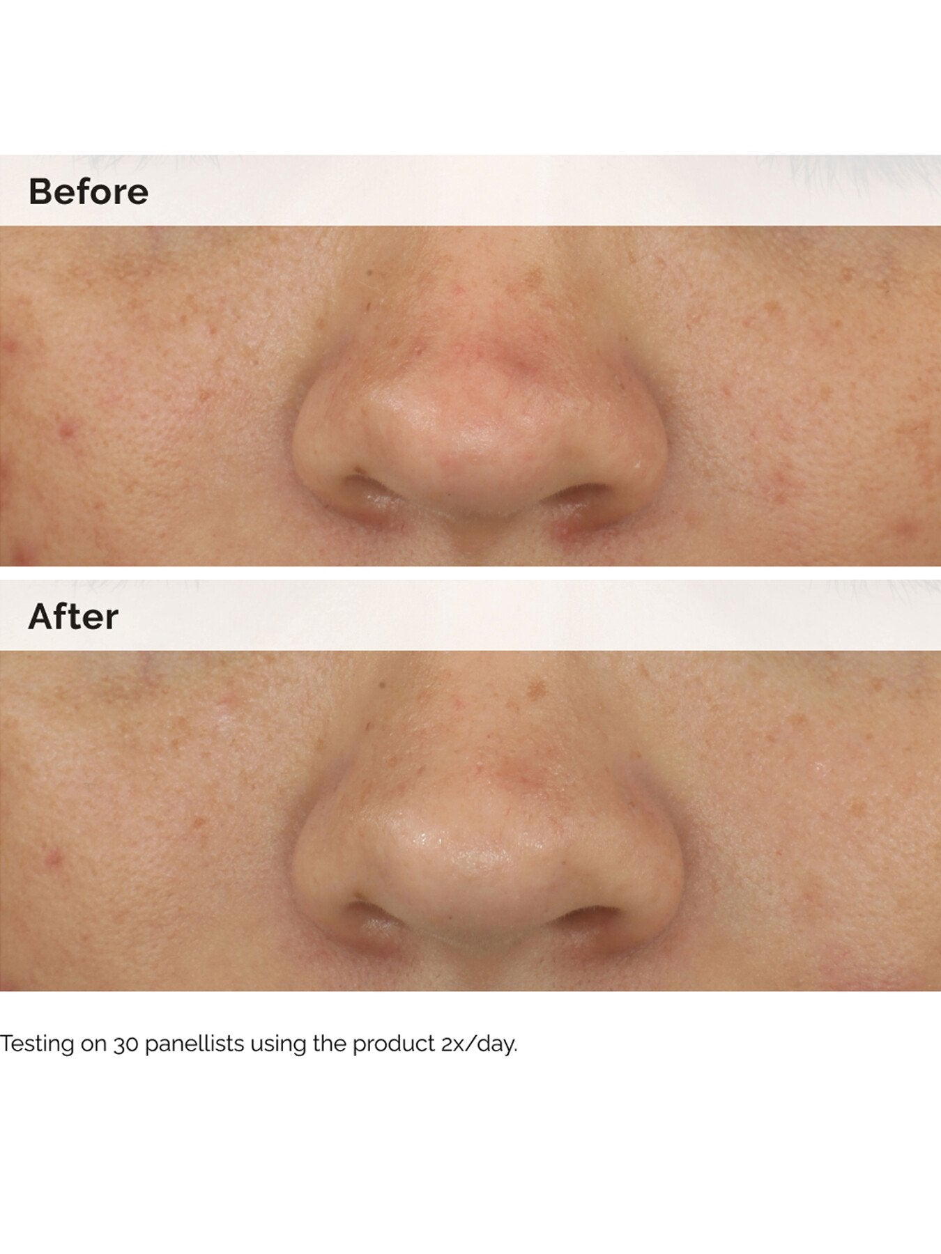 Balancing Clarifying Serum