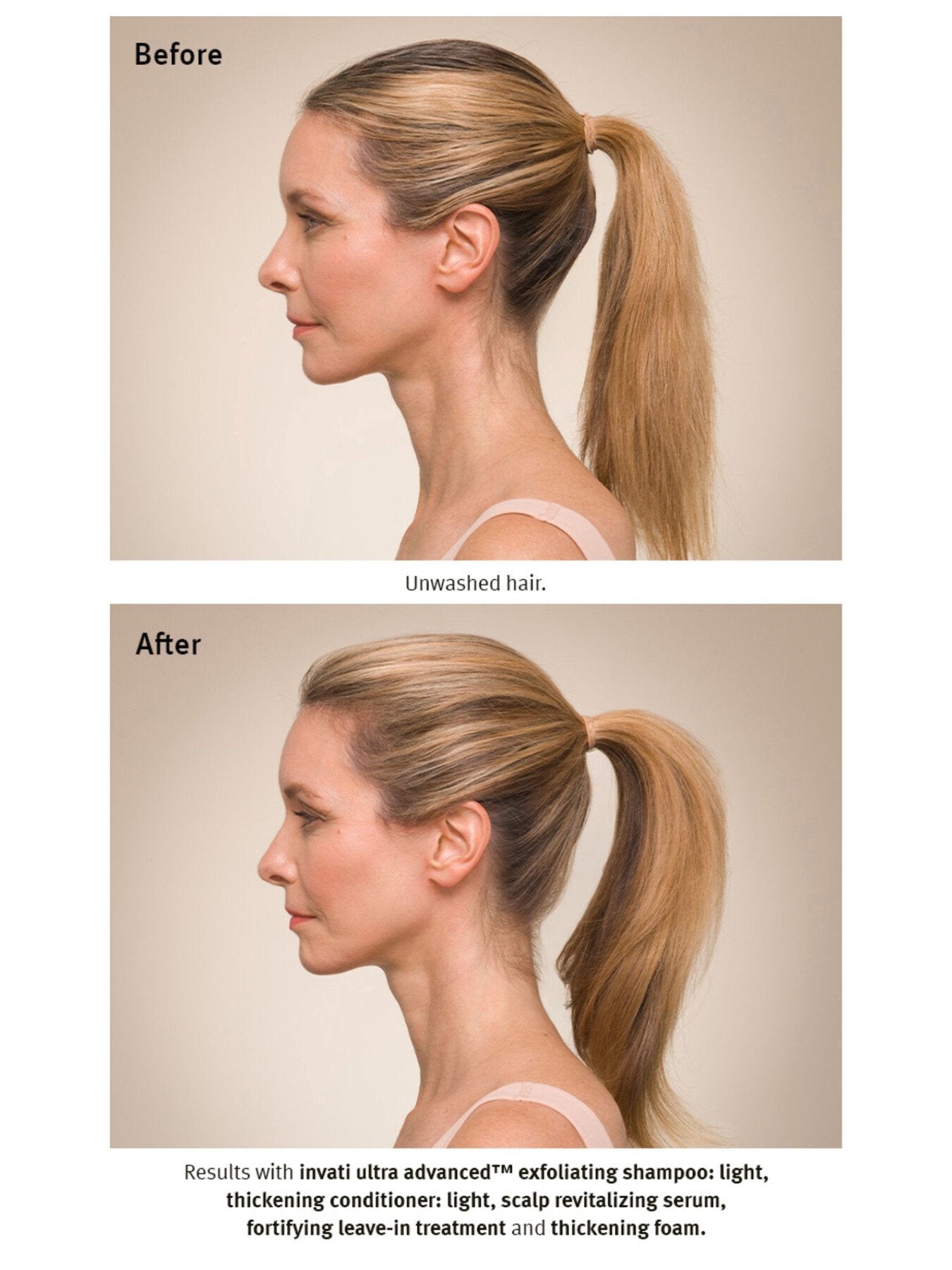 Invati Ultra Advanced™ Revitalizing Scalp Serum 30ml