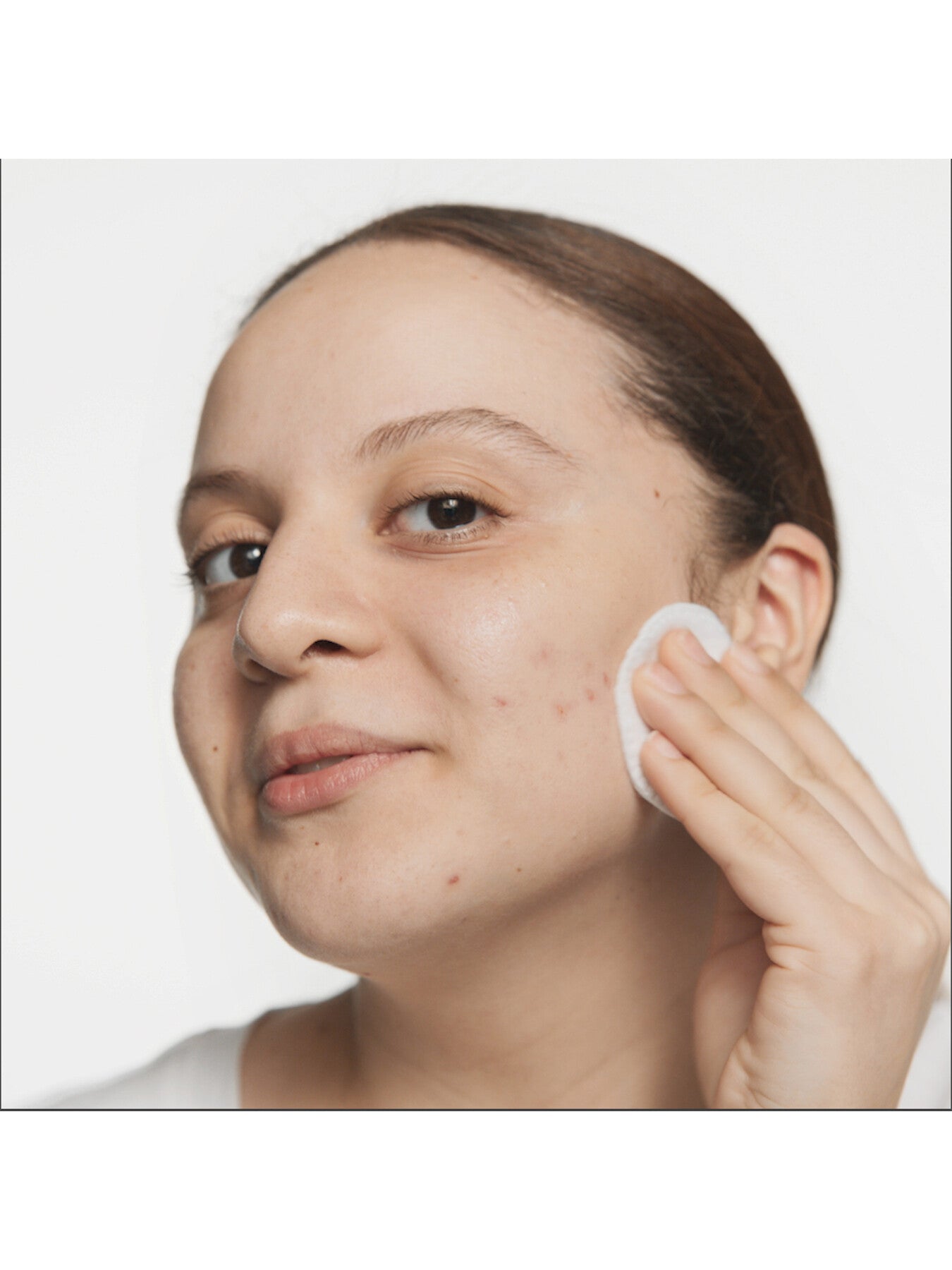 Skin School Supplies Anti-Blemish Basics Gift Set