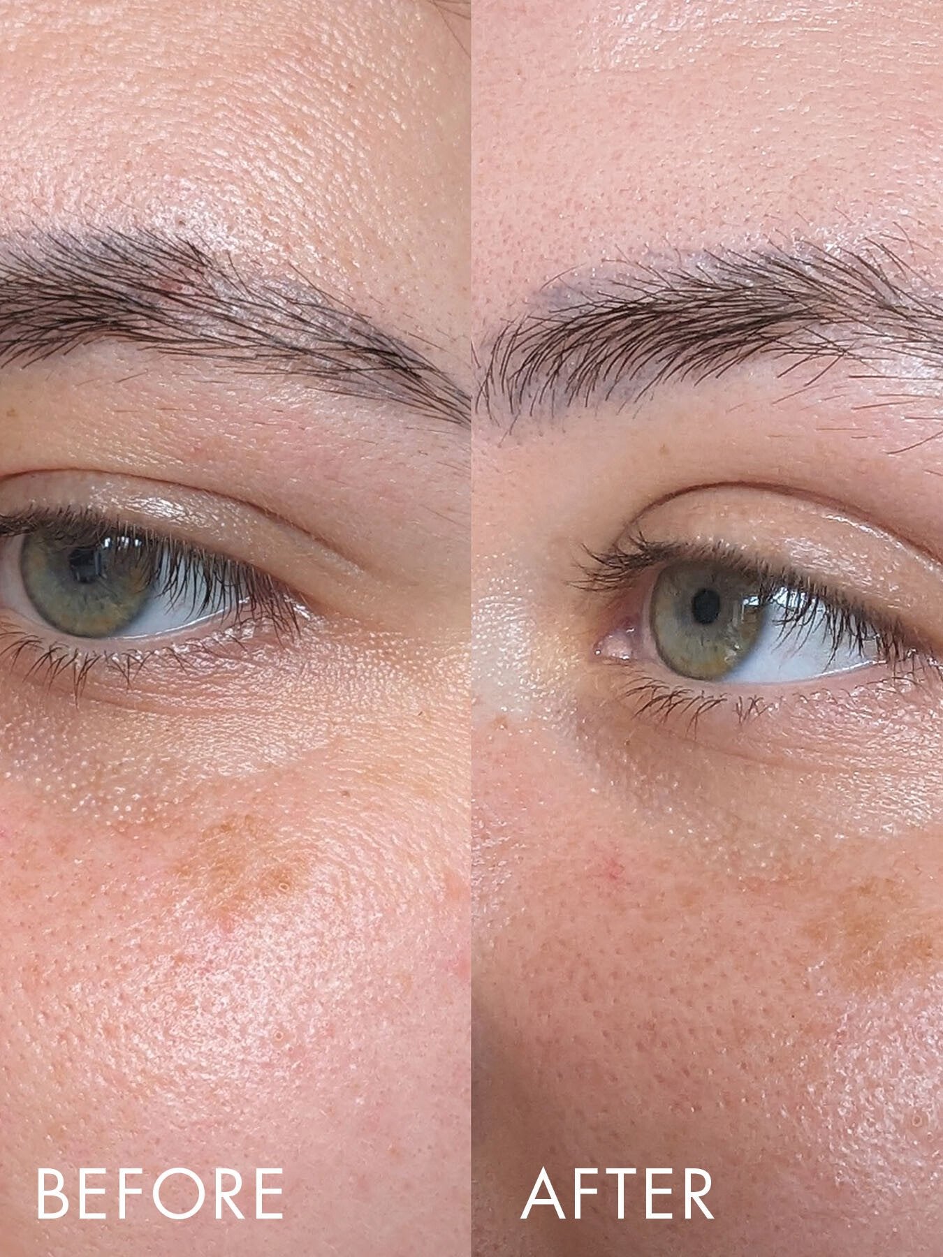 Time Retreat Smoothing Eye Complex 15ml