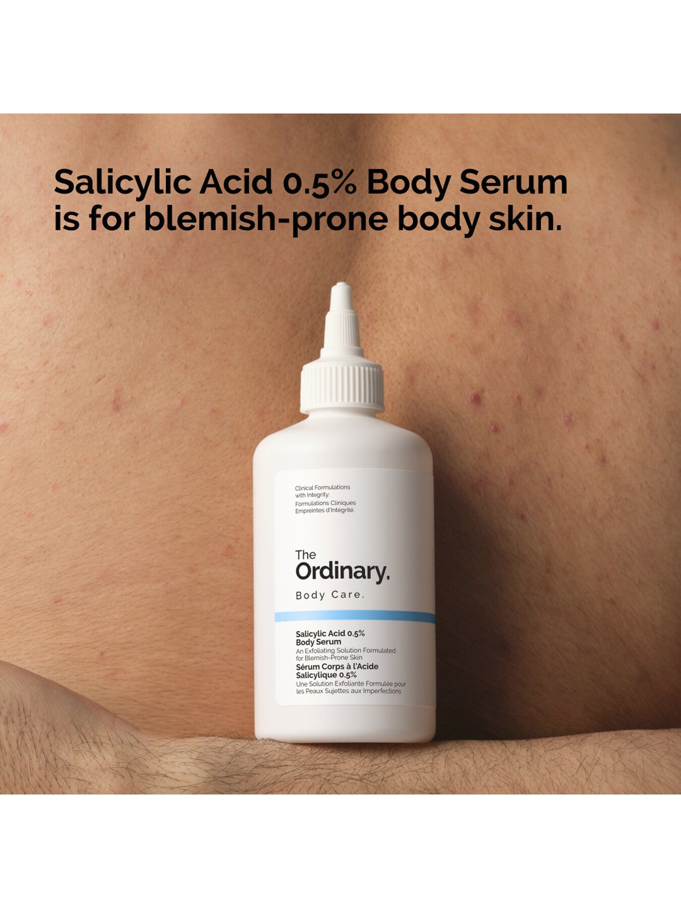 Salicylic Acid 0.5 Body Serum 240ml